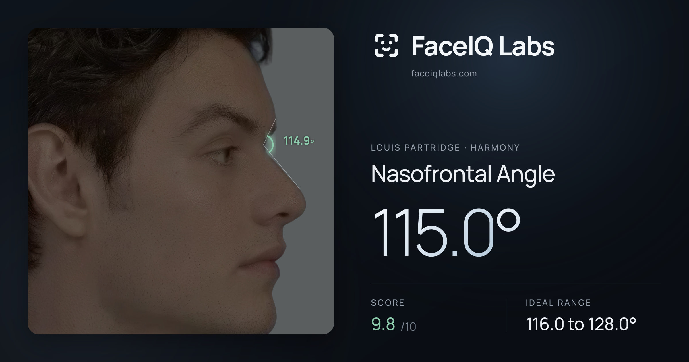 Louis Partridge Nasofrontal Angle: 115.0°, drawn on the photo