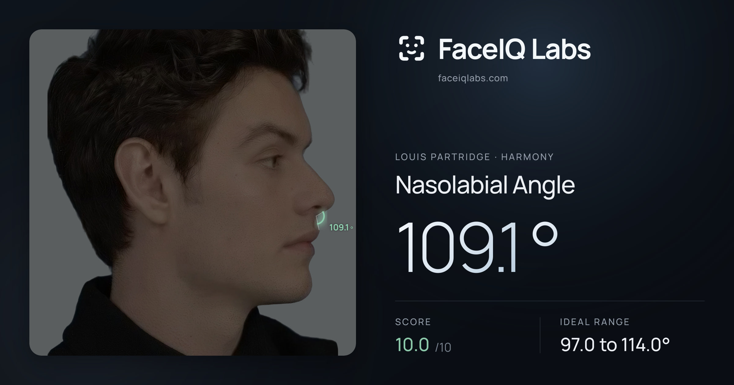 Louis Partridge Nasolabial Angle: 109.1°, drawn on the photo