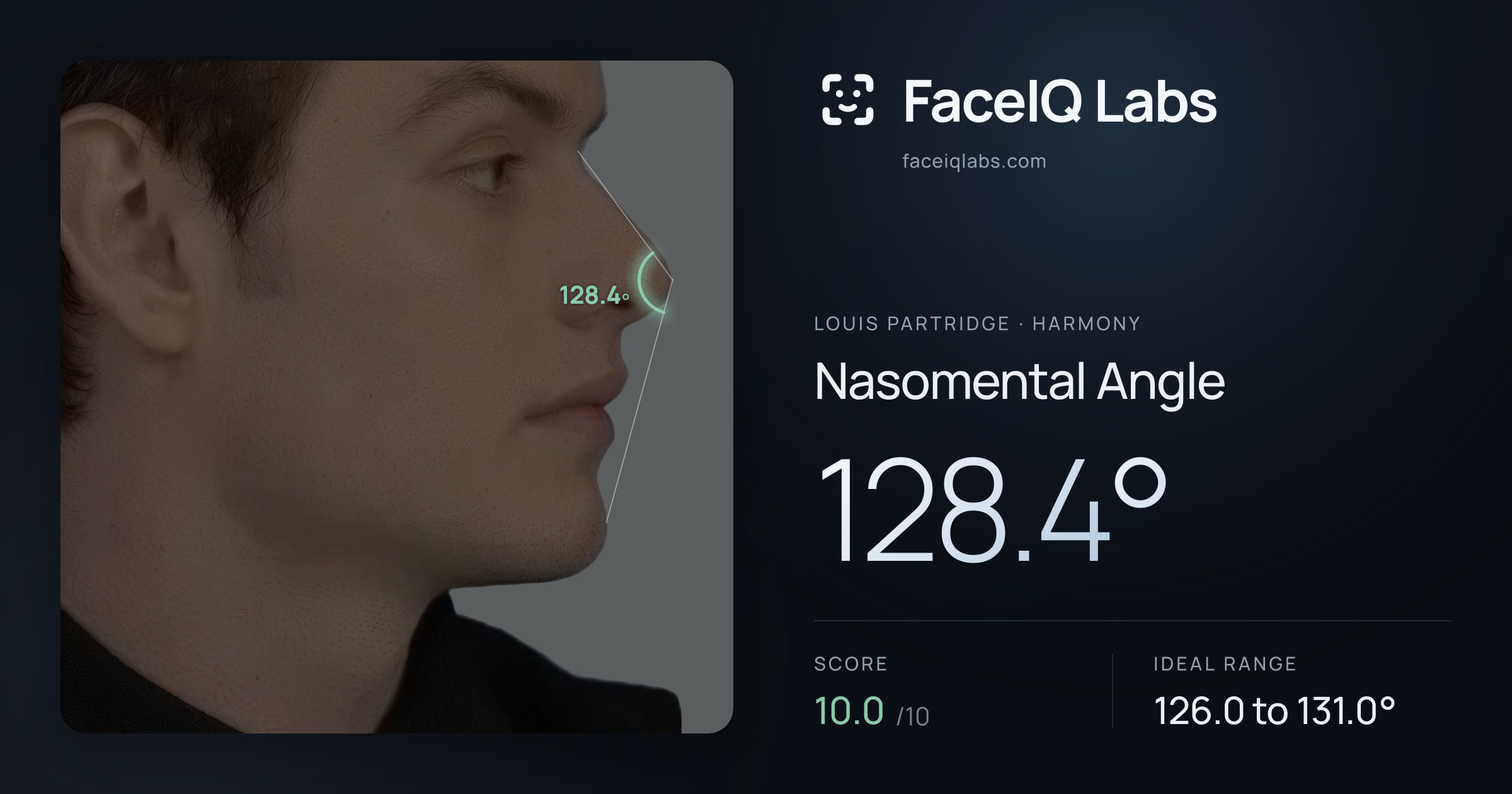 Louis Partridge Nasomental Angle: 128.4°, drawn on the photo