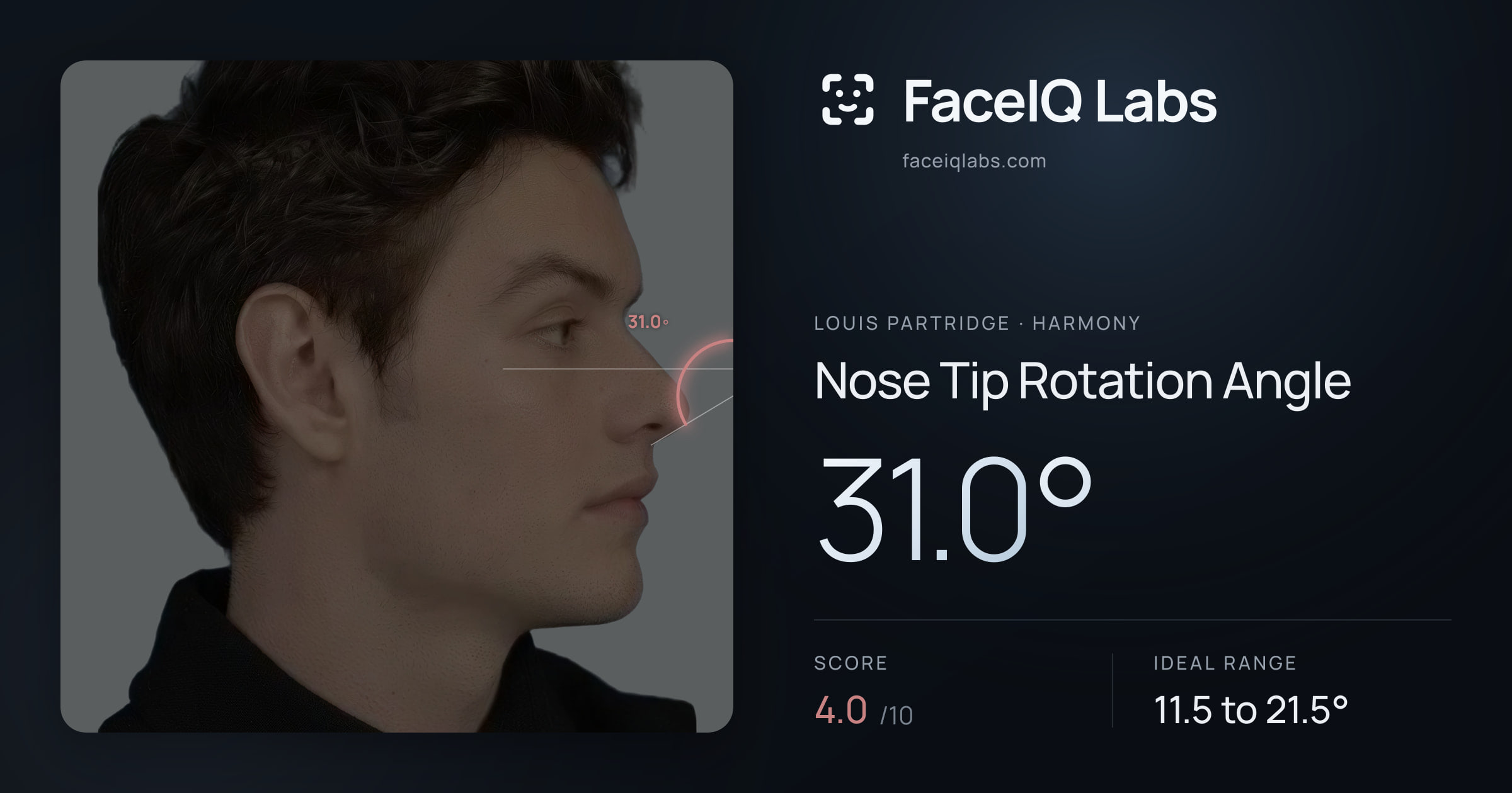 Louis Partridge Nose Tip Rotation Angle: 31.0°, drawn on the photo