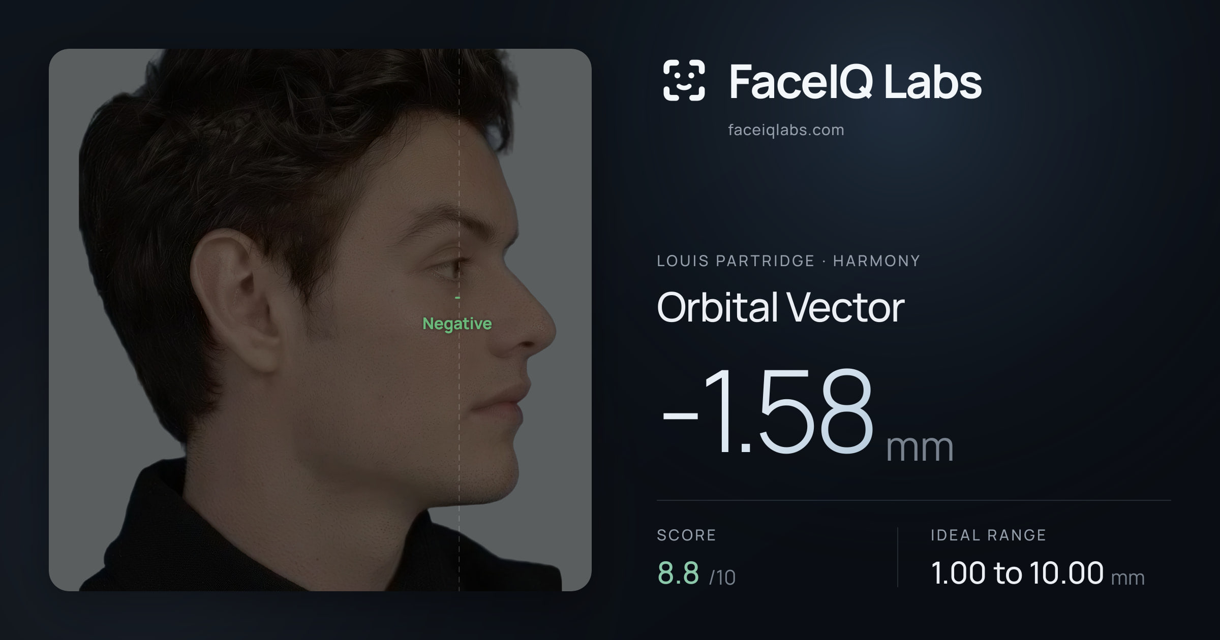 Louis Partridge Orbital Vector: -1.58mm, drawn on the photo