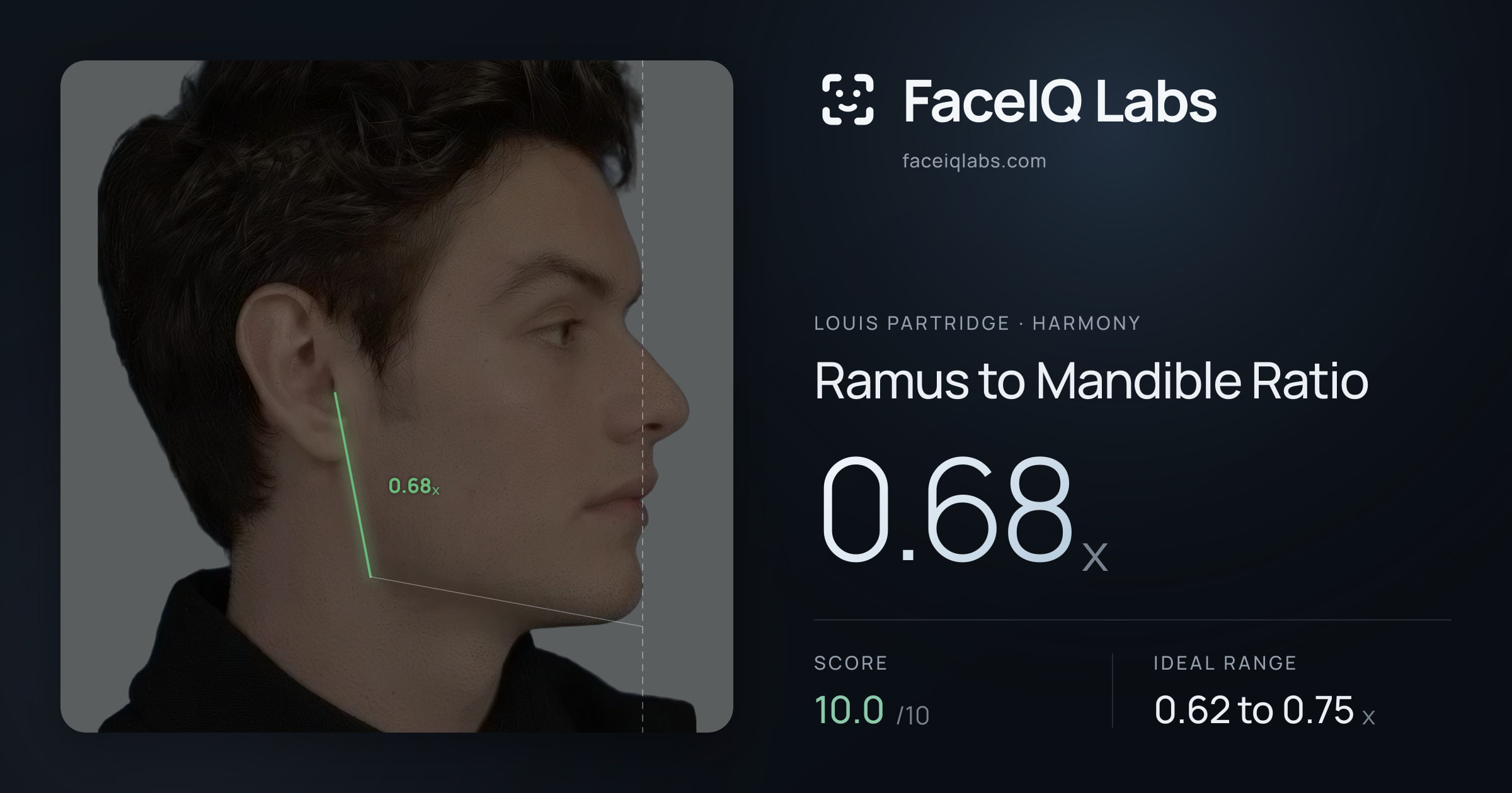 Louis Partridge Ramus to Mandible Ratio: 0.68x, drawn on the photo
