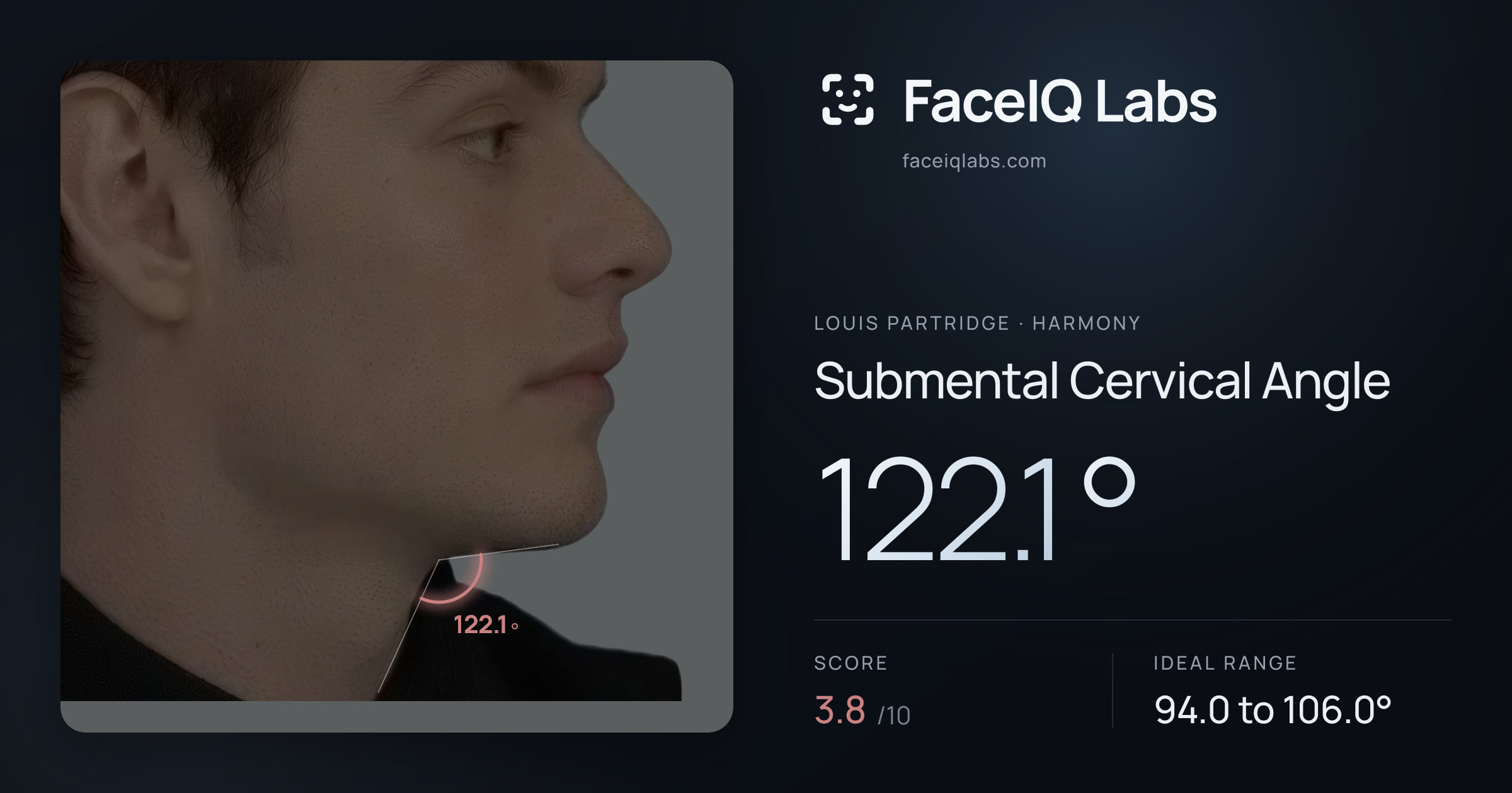 Louis Partridge Submental Cervical Angle: 122.1°, drawn on the photo