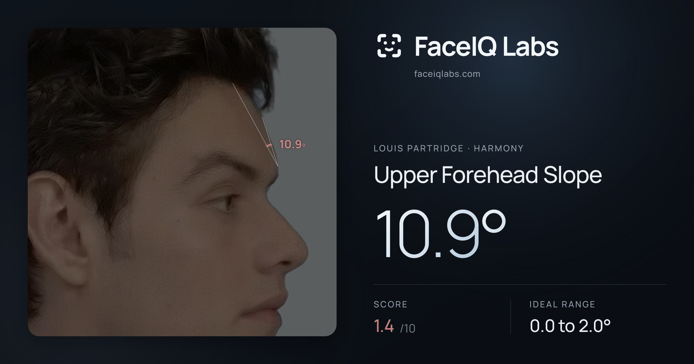 Louis Partridge Upper Forehead Slope: 10.9°, drawn on the photo