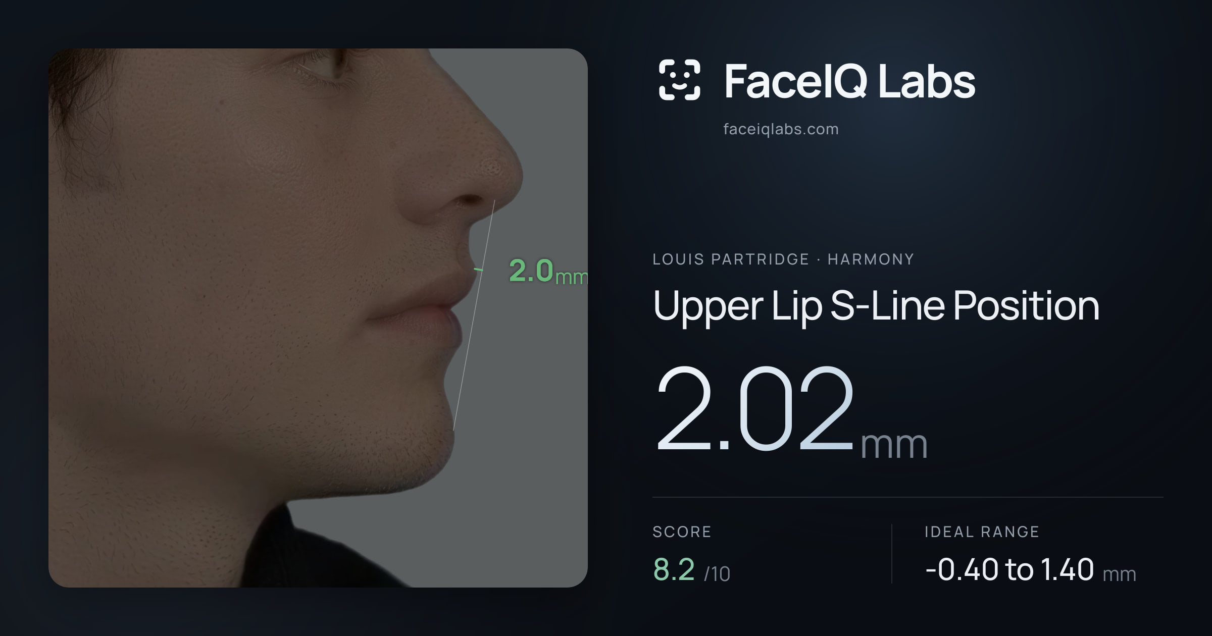 Louis Partridge Upper Lip S-Line Position: 2.02mm, drawn on the photo