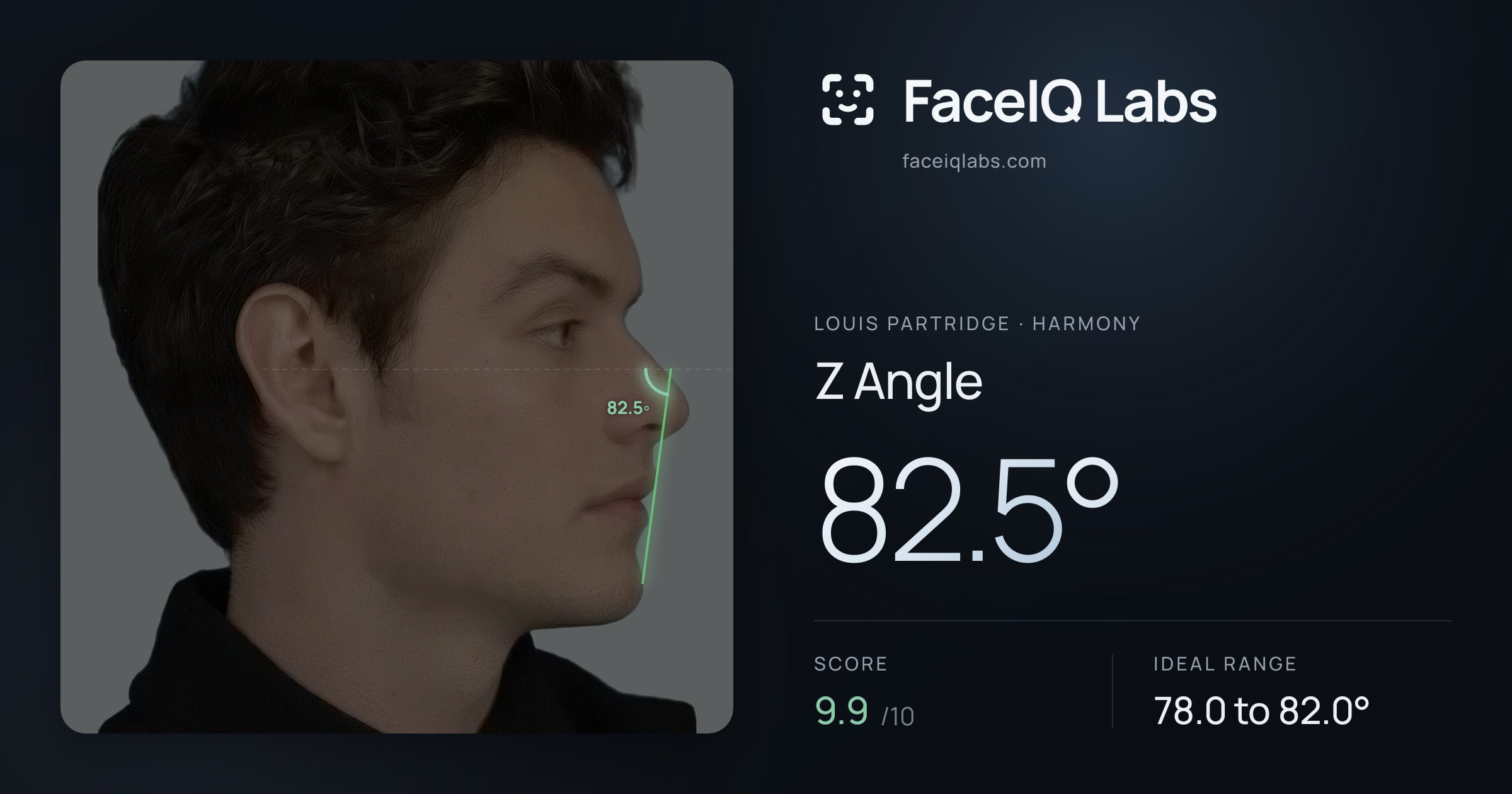Louis Partridge Z Angle: 82.5°, drawn on the photo