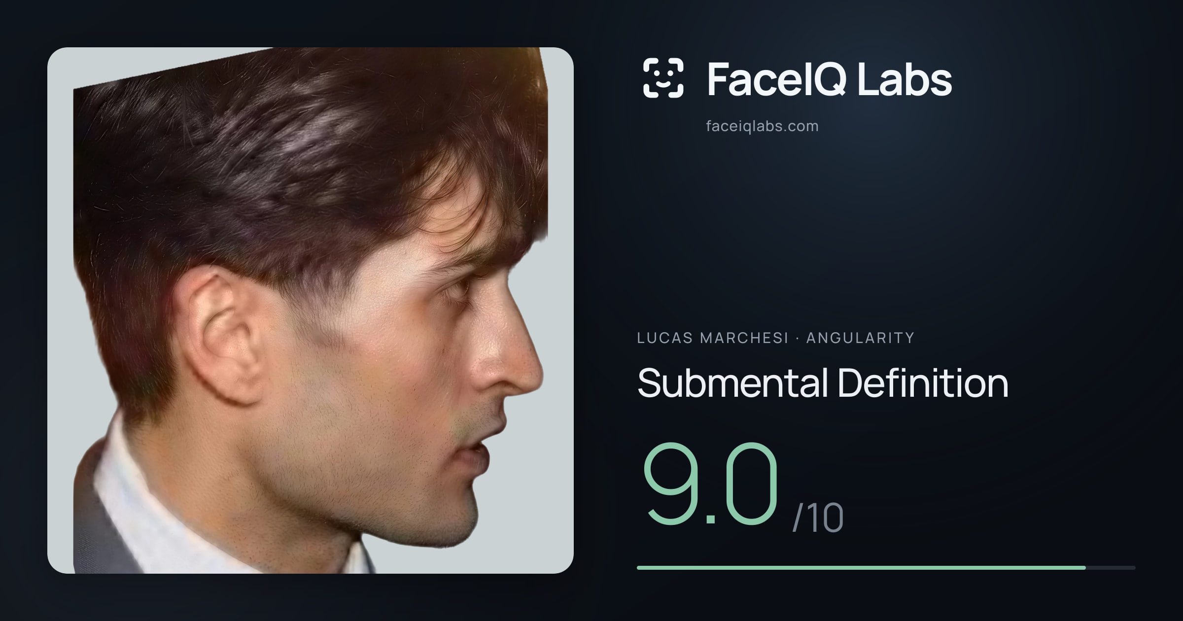 Lucas Marchesi Submental Definition: 9.0/10, drawn on the photo
