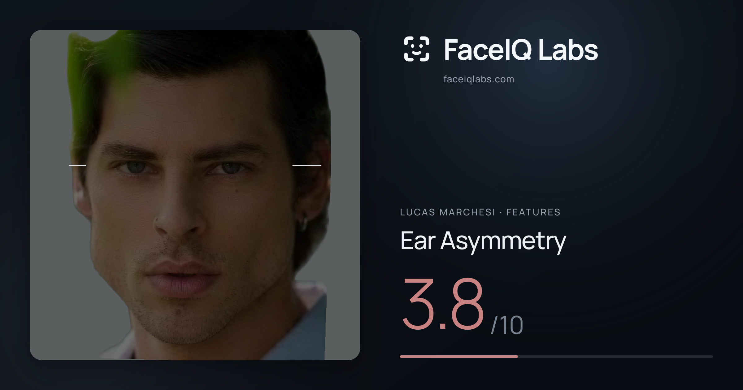 Lucas Marchesi Ear Asymmetry: 3.8/10, drawn on the photo