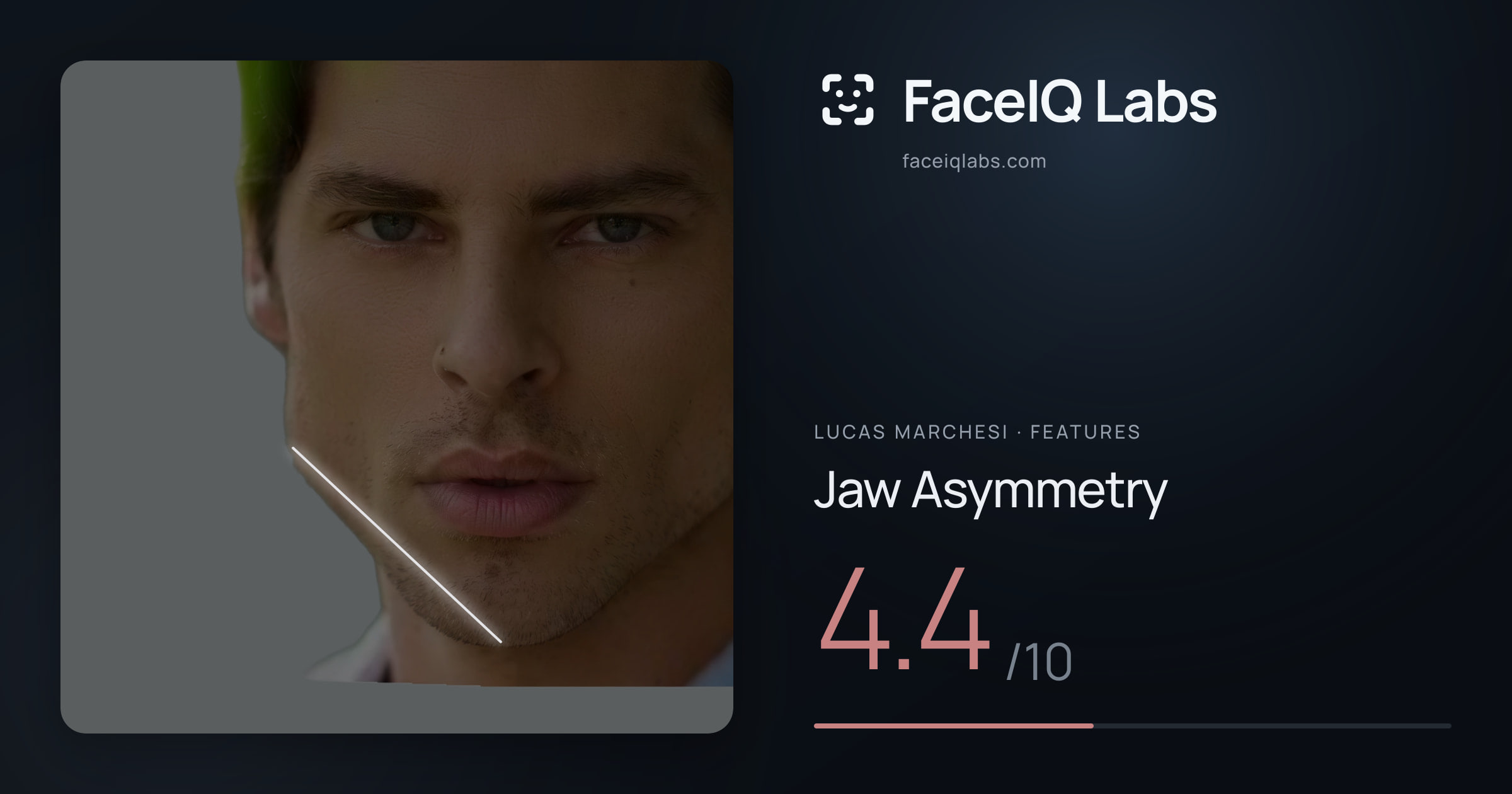 Lucas Marchesi Jaw Asymmetry: 4.4/10, drawn on the photo