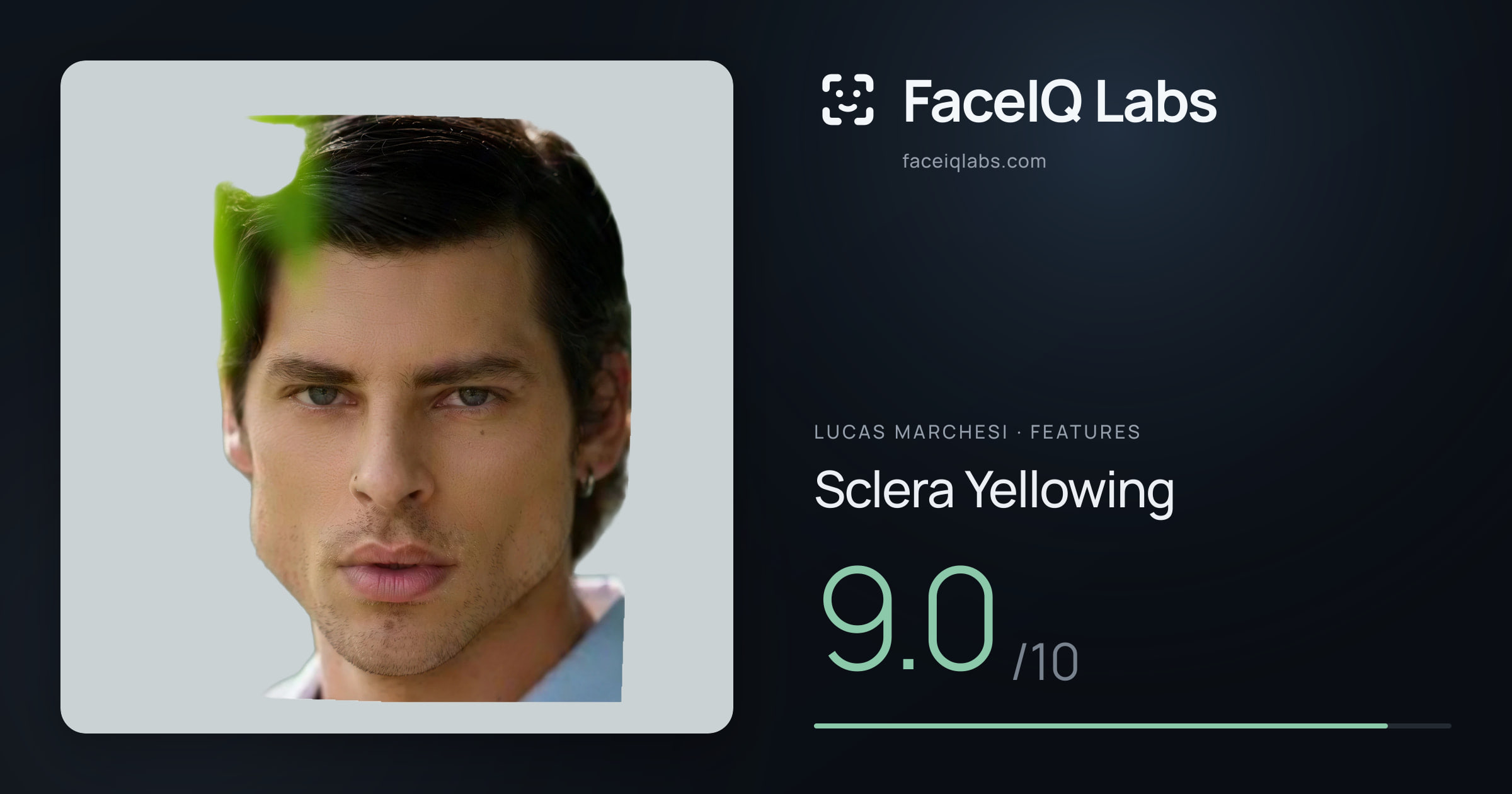 Lucas Marchesi Sclera Yellowing: 9.0/10, drawn on the photo