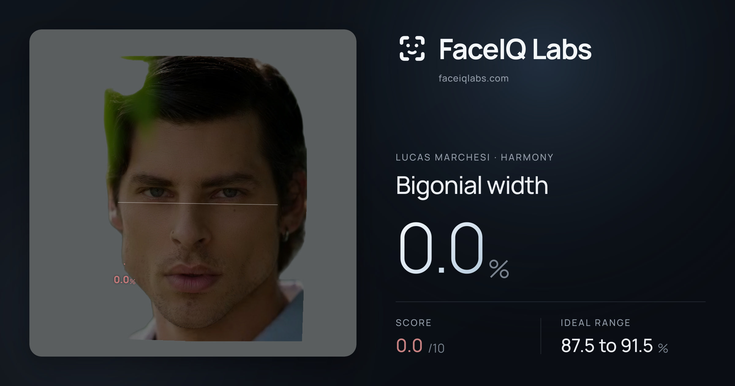 Lucas Marchesi Bigonial width: 0.0%, drawn on the photo