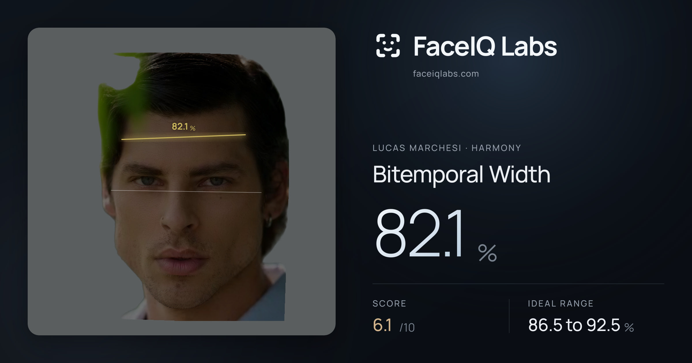 Lucas Marchesi Bitemporal Width: 82.1%, drawn on the photo