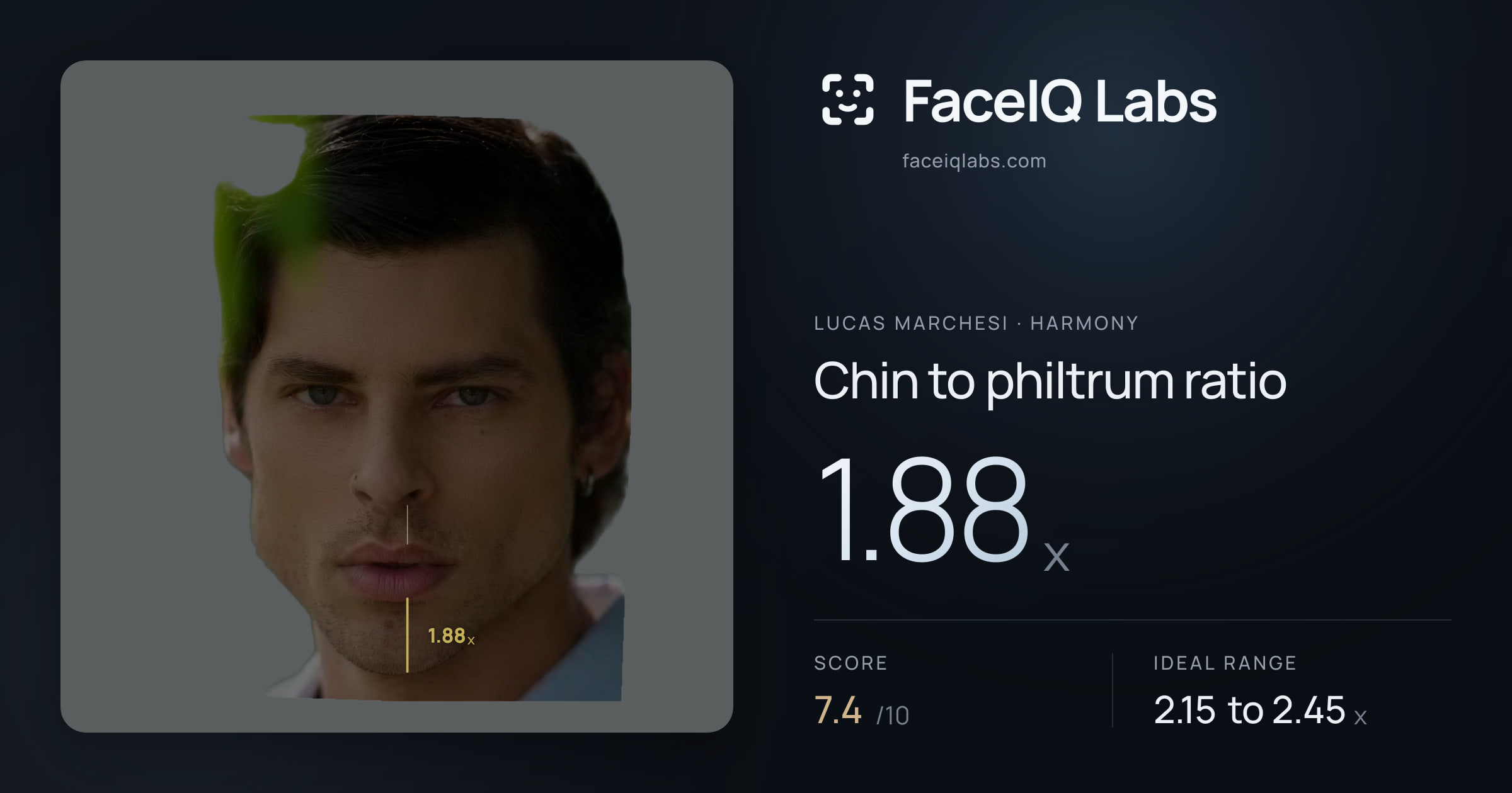 Lucas Marchesi Chin to philtrum ratio: 1.88x, drawn on the photo