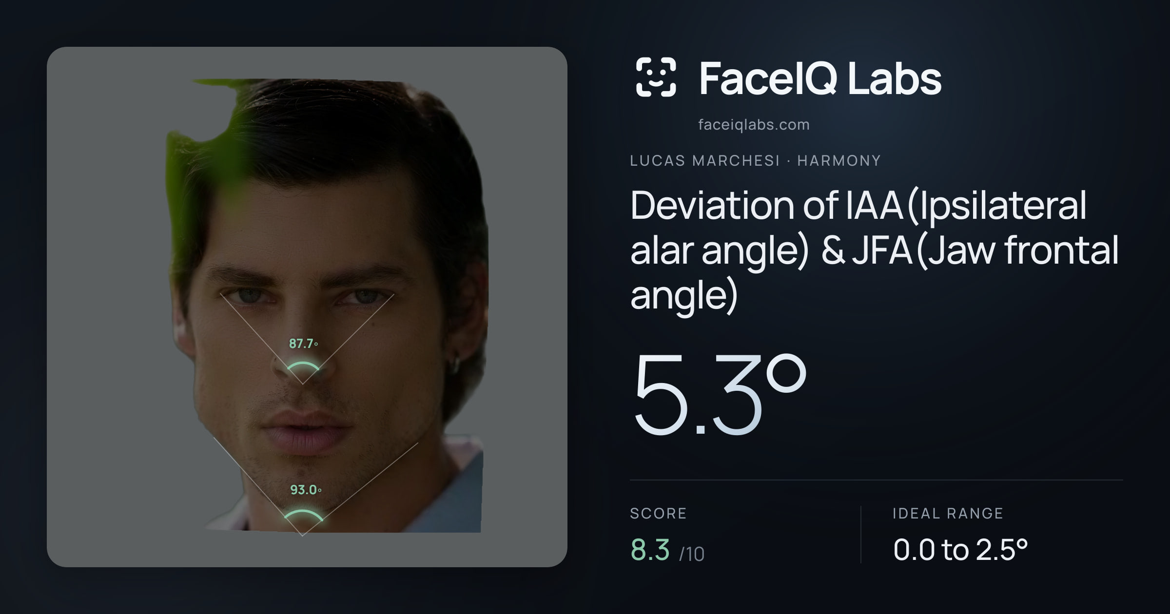 Lucas Marchesi Deviation of IAA(Ipsilateral alar angle) & JFA(Jaw frontal angle): 5.3°, drawn on the photo