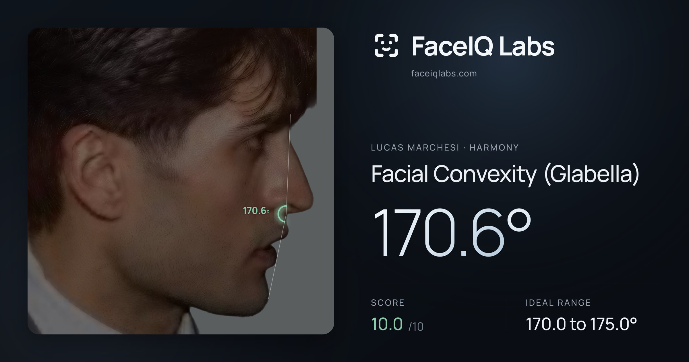 Lucas Marchesi Facial Convexity (Glabella): 170.6°, drawn on the photo