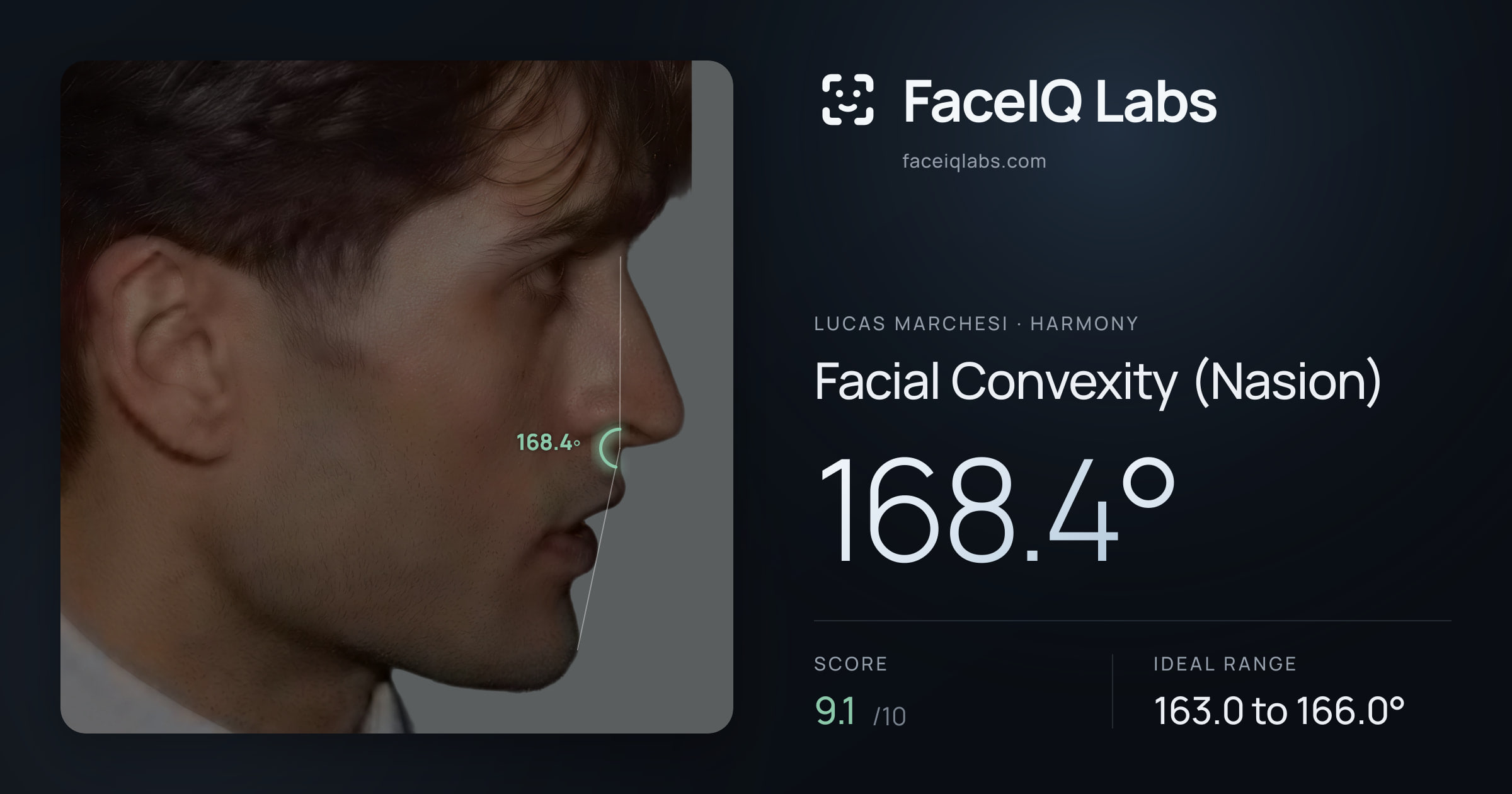Lucas Marchesi Facial Convexity (Nasion): 168.4°, drawn on the photo