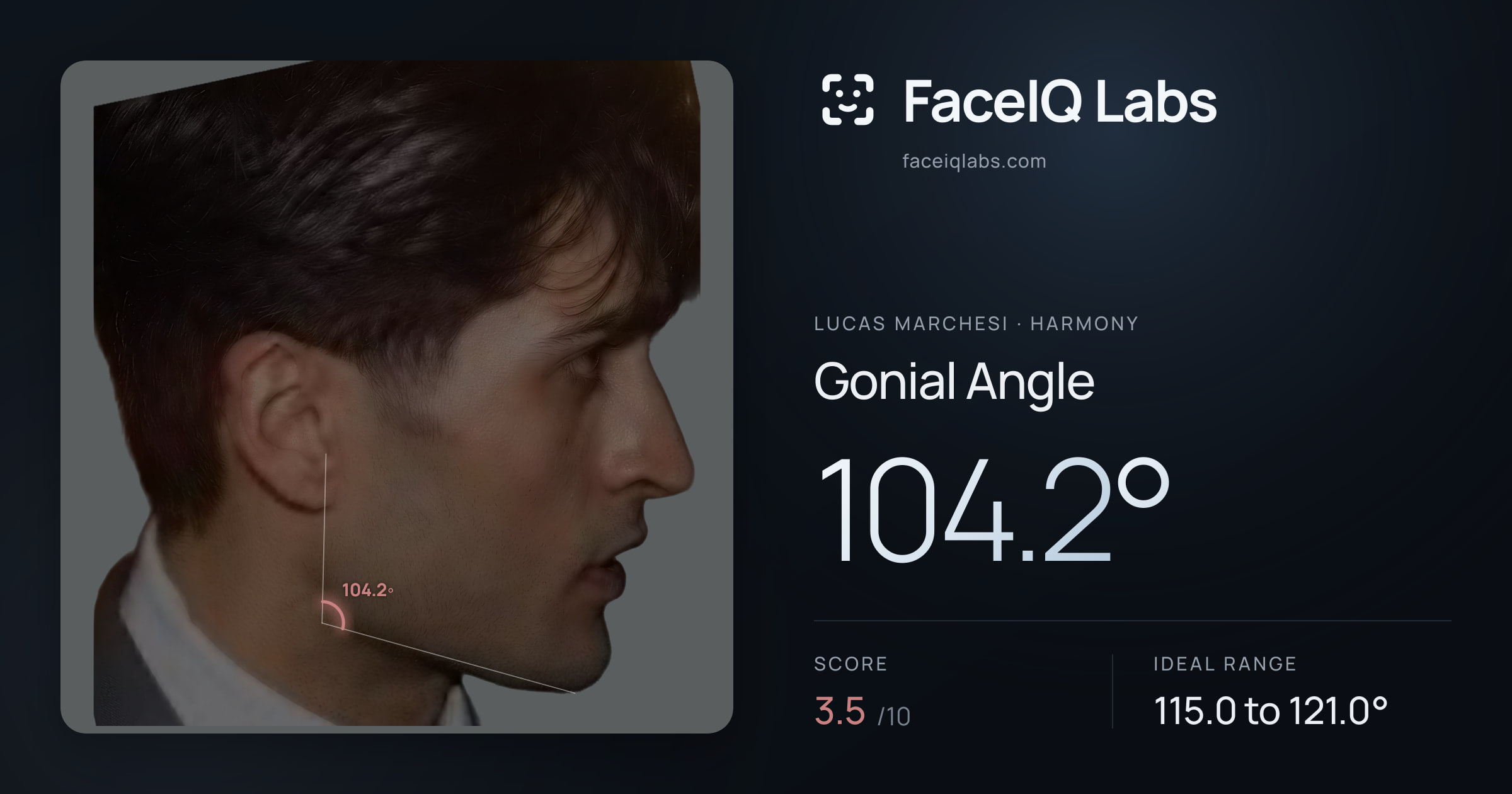 Lucas Marchesi Gonial Angle: 104.2°, drawn on the photo