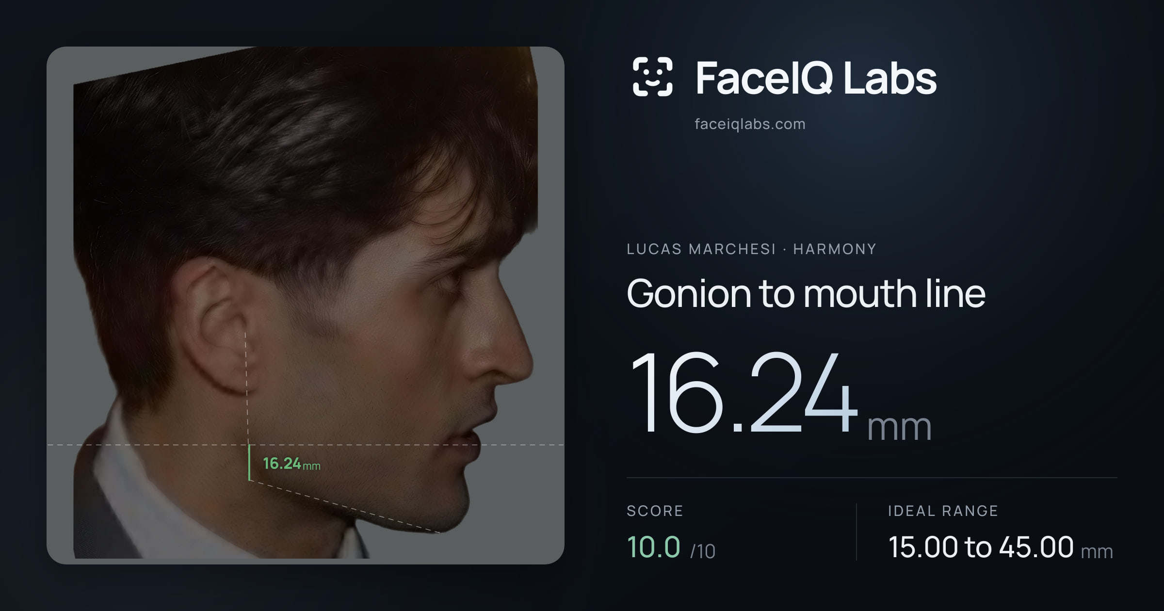 Lucas Marchesi Gonion to mouth line: 16.24mm, drawn on the photo