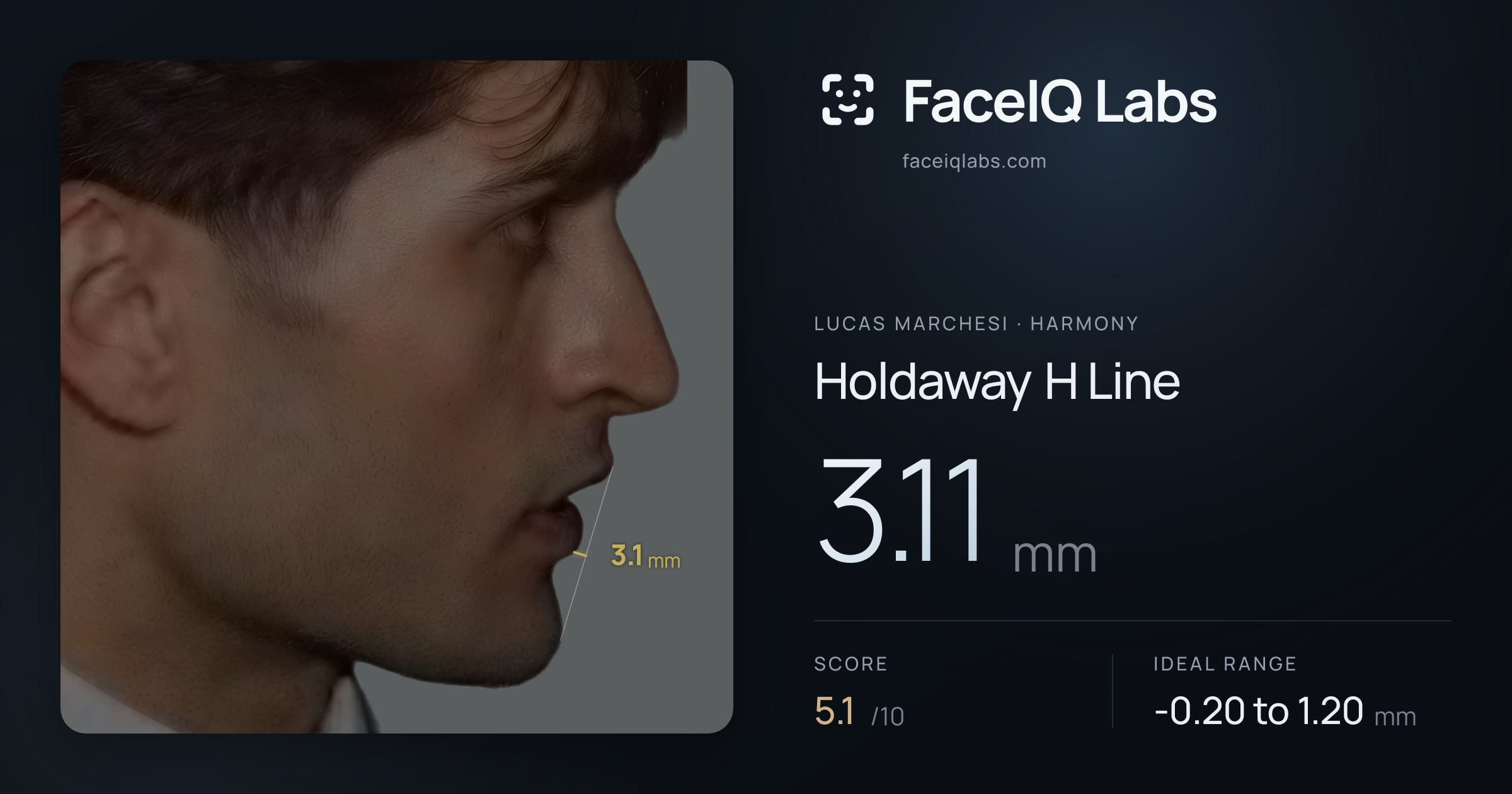 Lucas Marchesi Holdaway H Line: 3.11mm, drawn on the photo