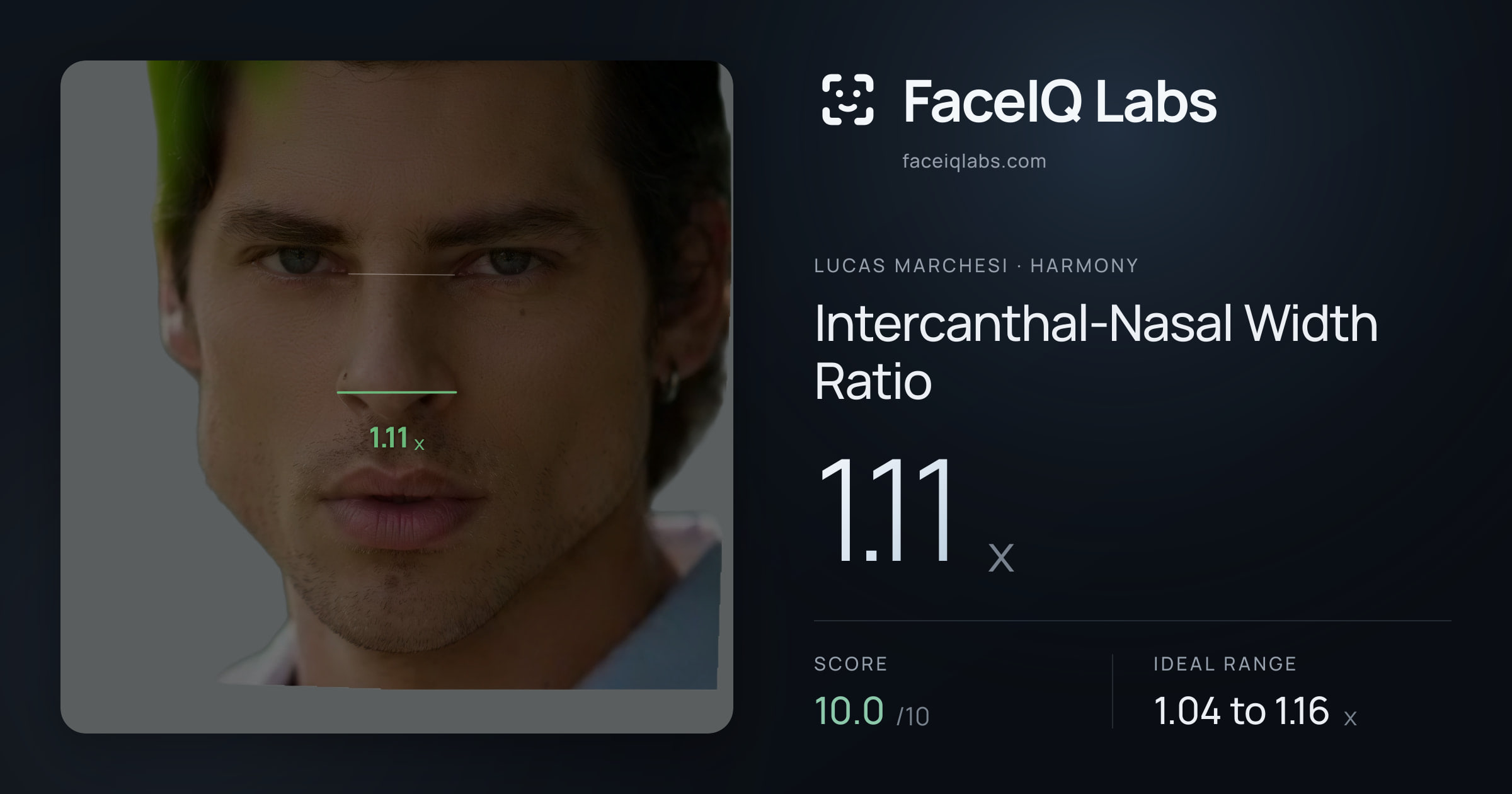 Lucas Marchesi Intercanthal-Nasal Width Ratio: 1.11x, drawn on the photo