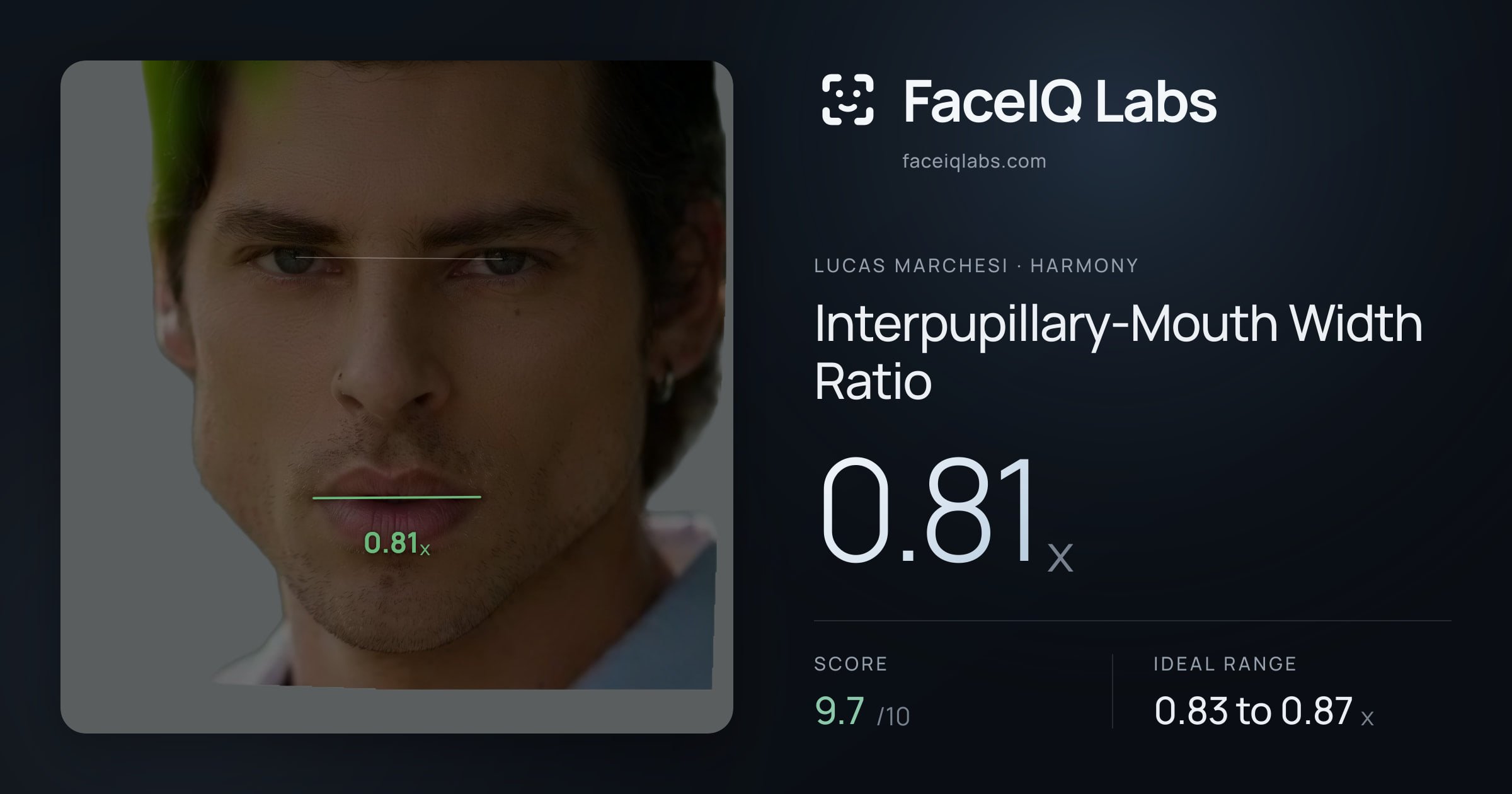Lucas Marchesi Interpupillary-Mouth Width Ratio: 0.81x, drawn on the photo