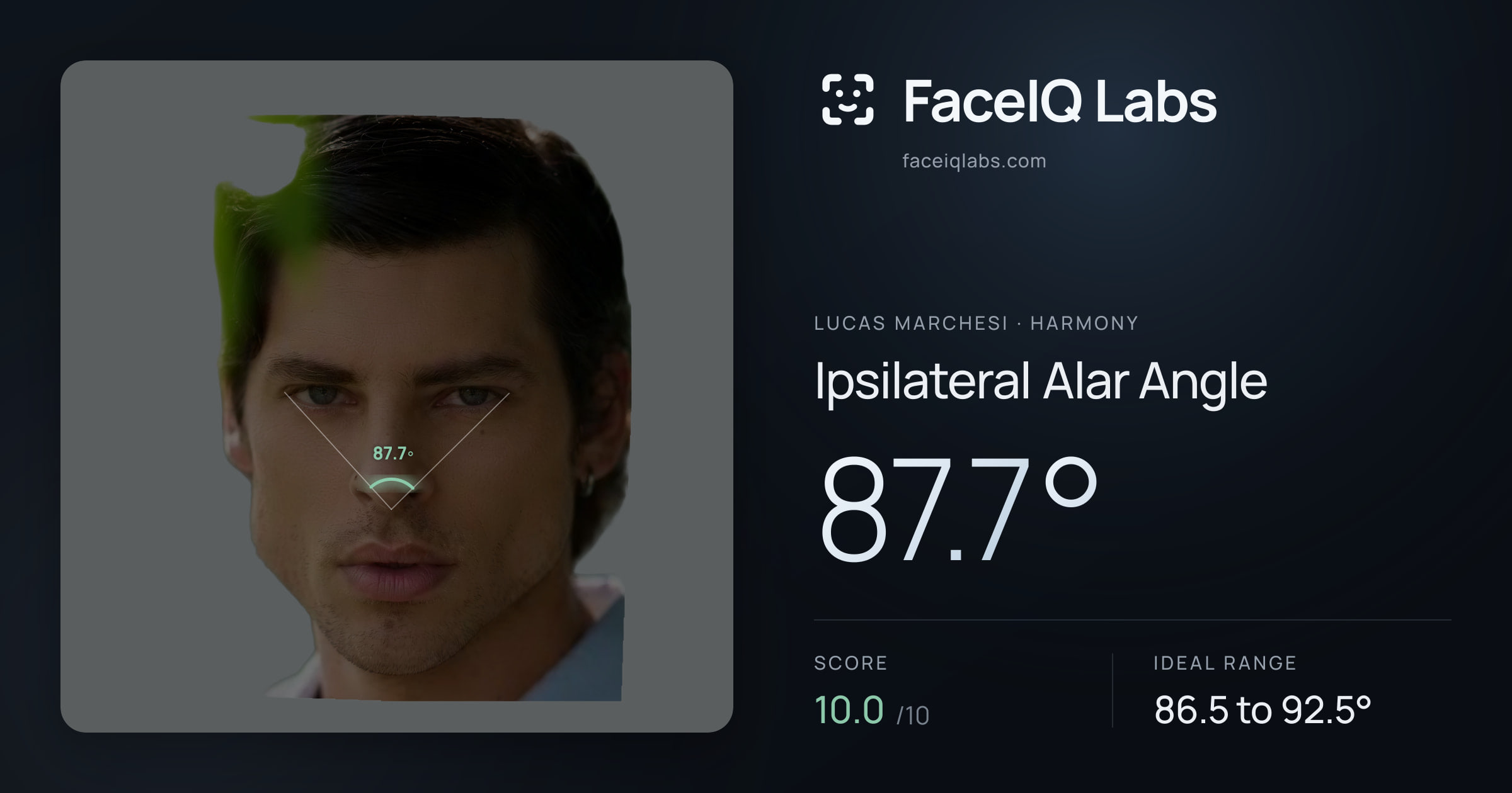 Lucas Marchesi Ipsilateral Alar Angle: 87.7°, drawn on the photo