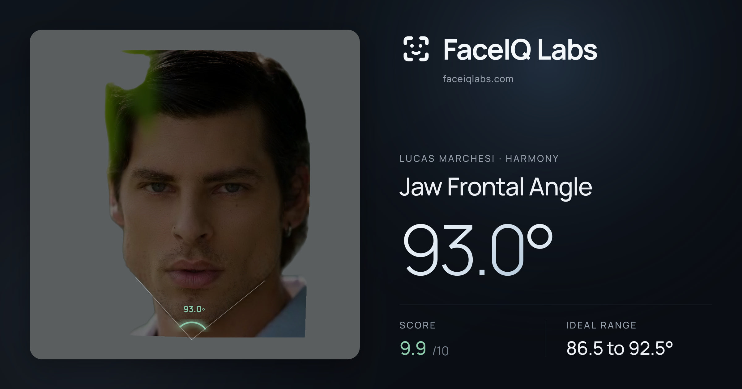 Lucas Marchesi Jaw Frontal Angle: 93.0°, drawn on the photo