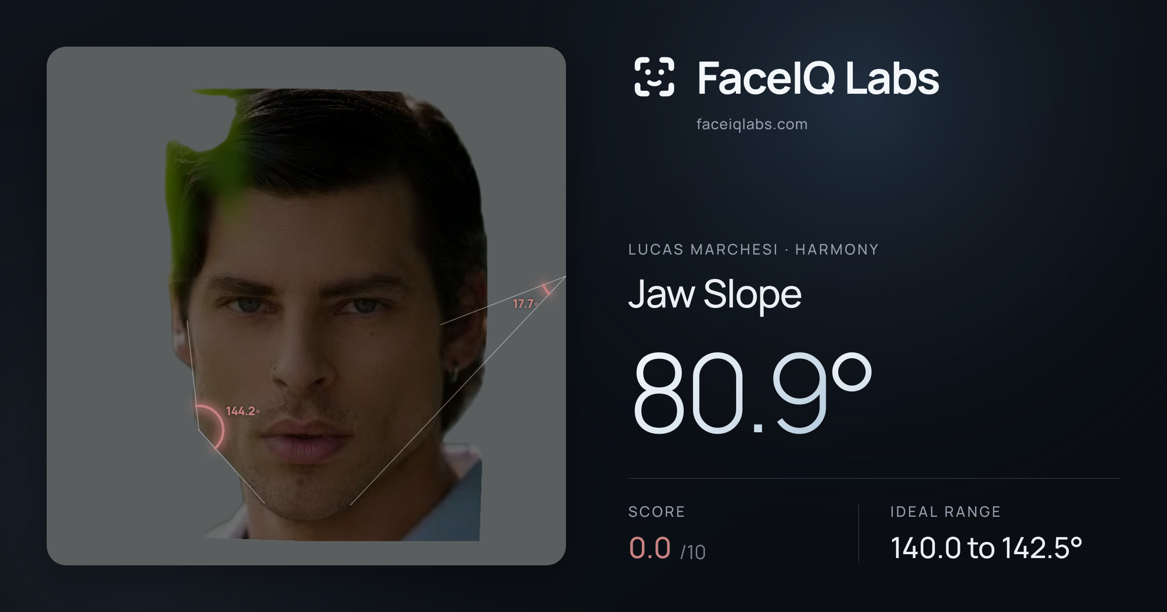 Lucas Marchesi Jaw Slope: 80.9°, drawn on the photo