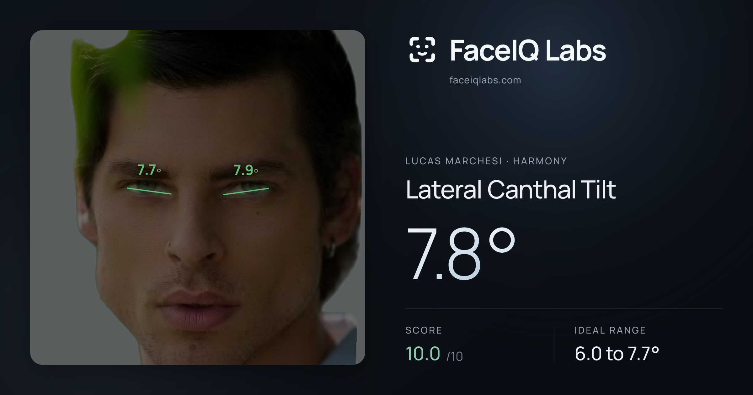 Lucas Marchesi Lateral Canthal Tilt: 7.8°, drawn on the photo