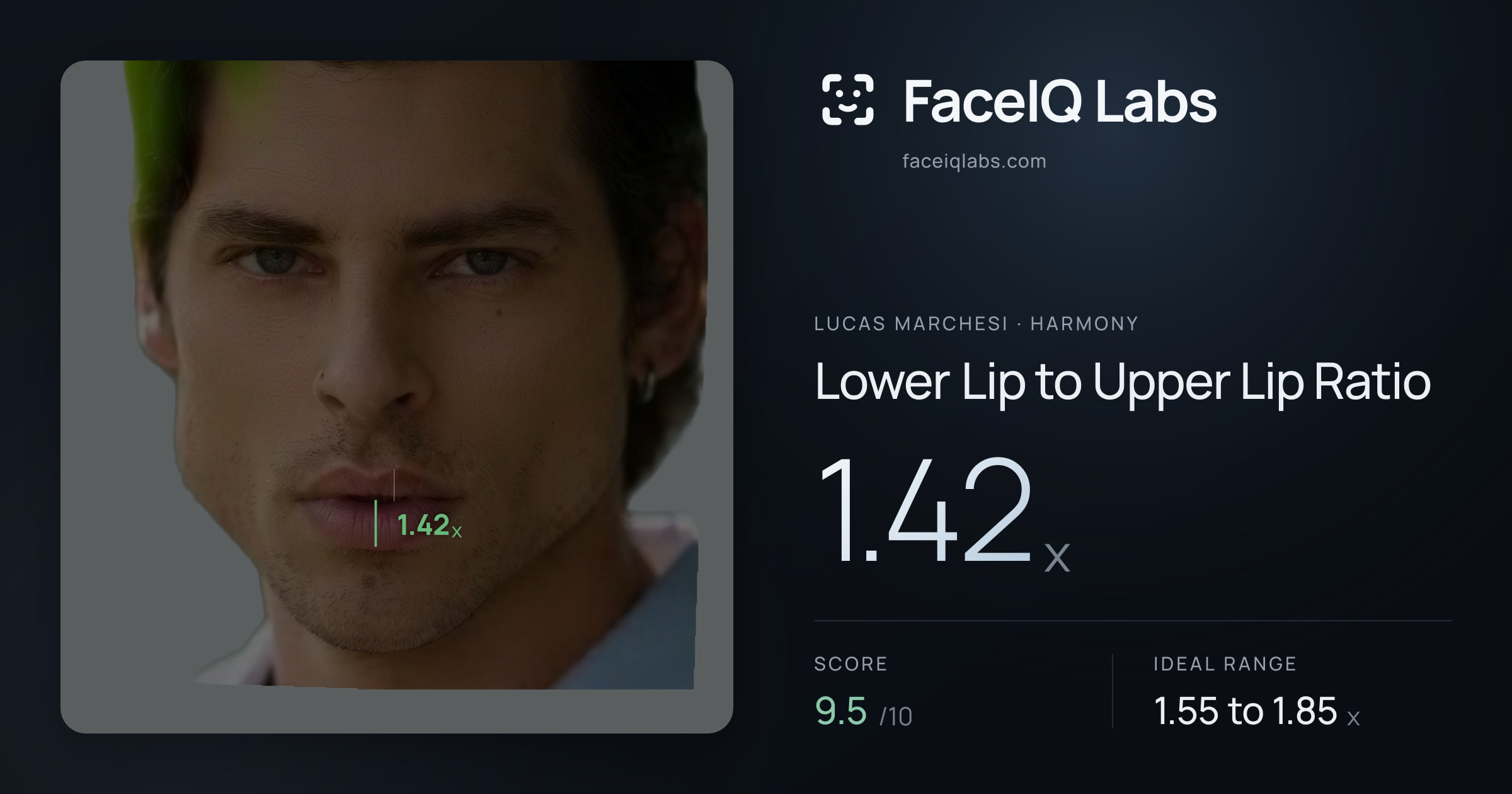 Lucas Marchesi Lower Lip to Upper Lip Ratio: 1.42x, drawn on the photo