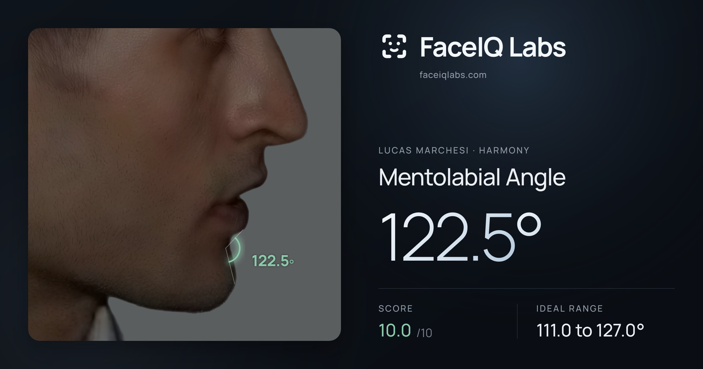 Lucas Marchesi Mentolabial Angle: 122.5°, drawn on the photo