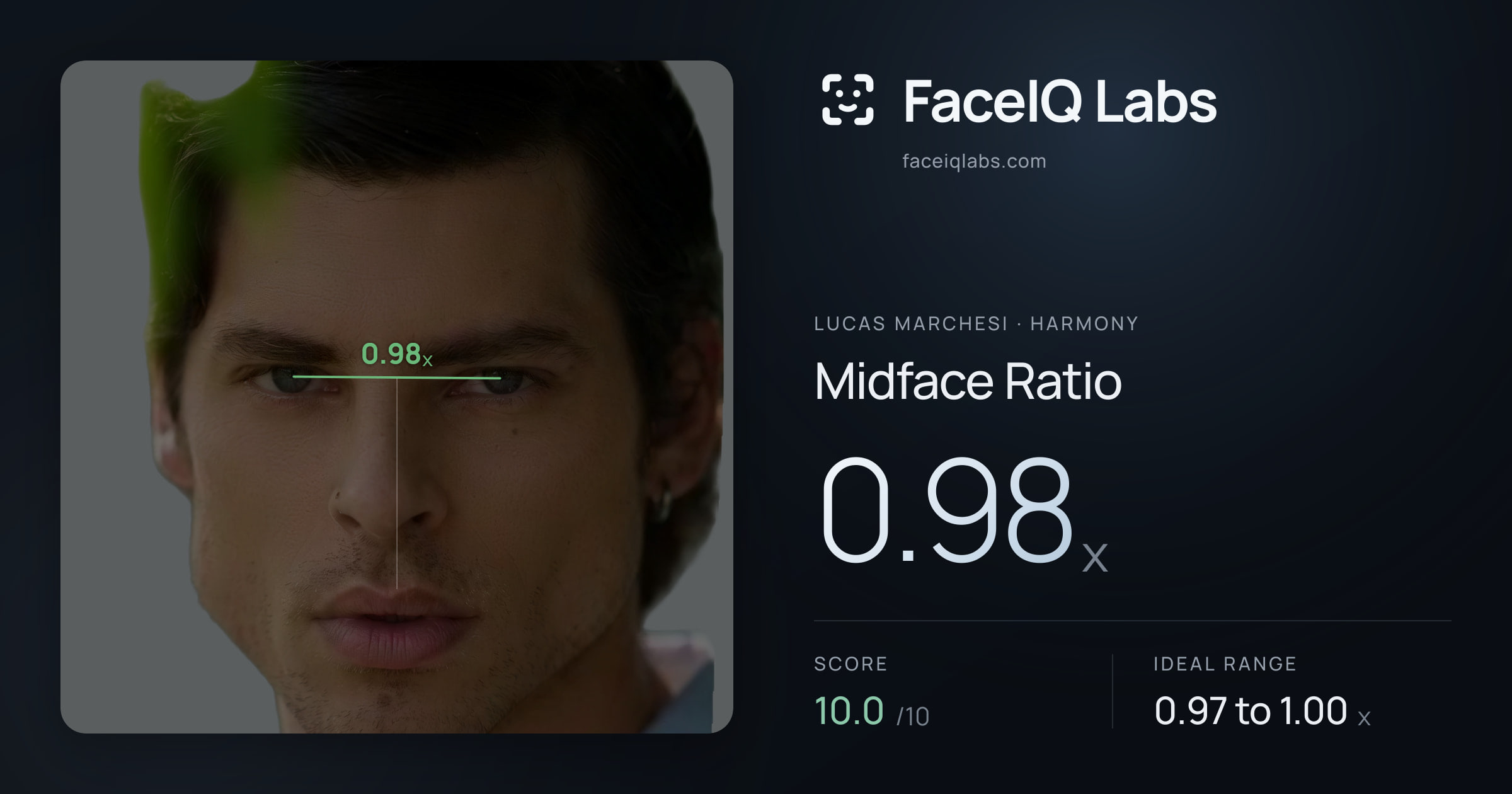 Lucas Marchesi Midface Ratio: 0.98x, drawn on the photo