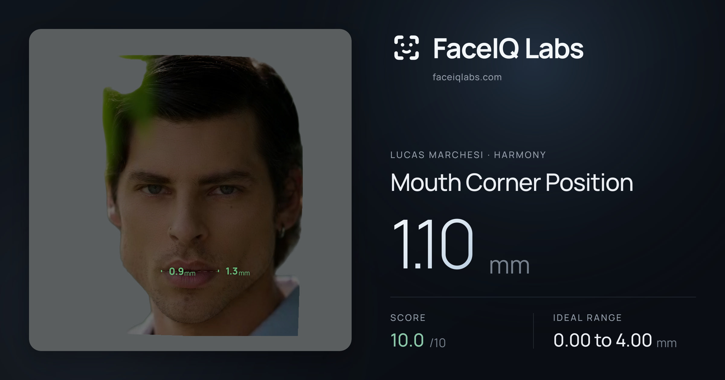 Lucas Marchesi Mouth Corner Position: 1.10mm, drawn on the photo