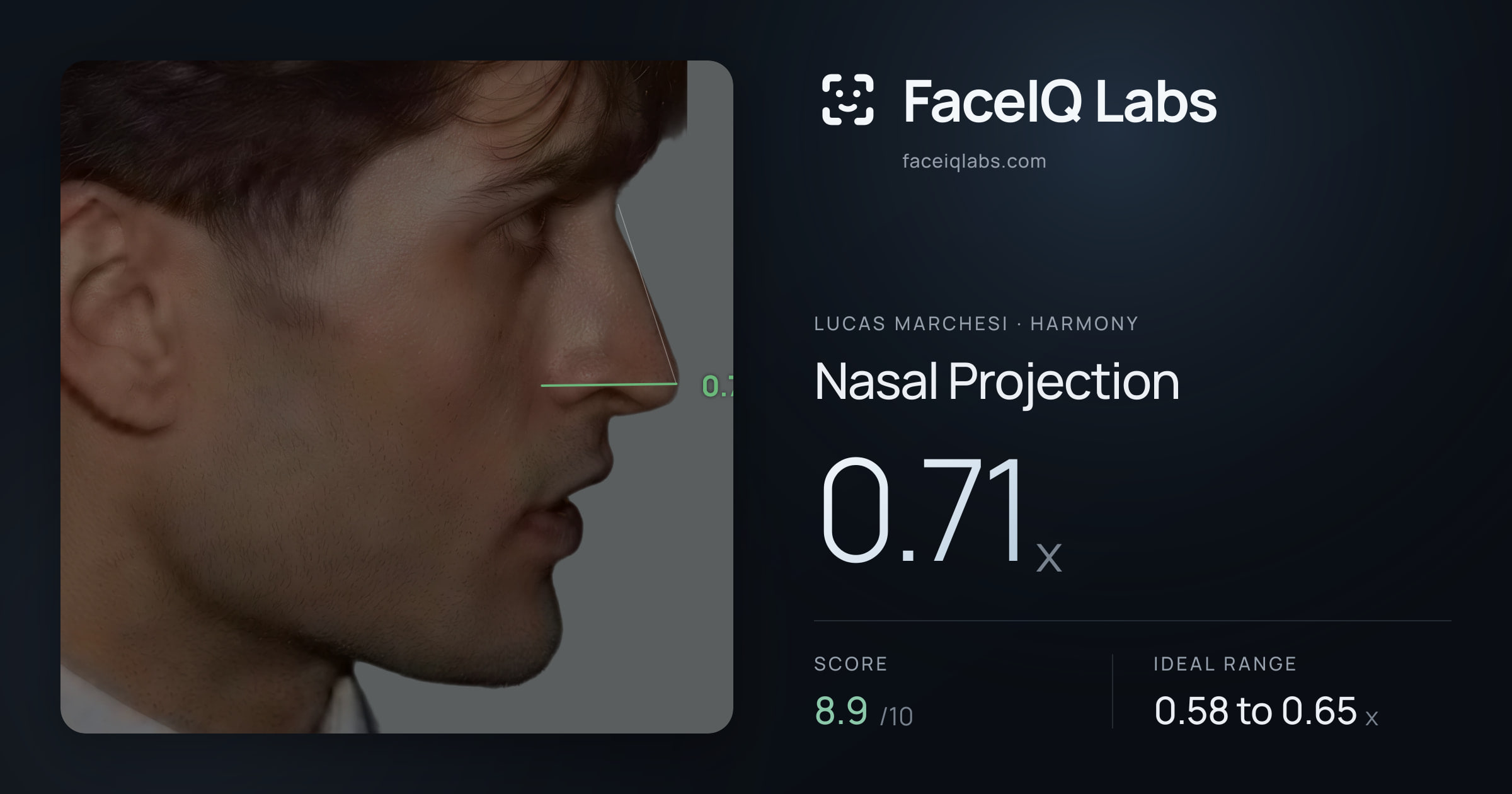Lucas Marchesi Nasal Projection: 0.71x, drawn on the photo
