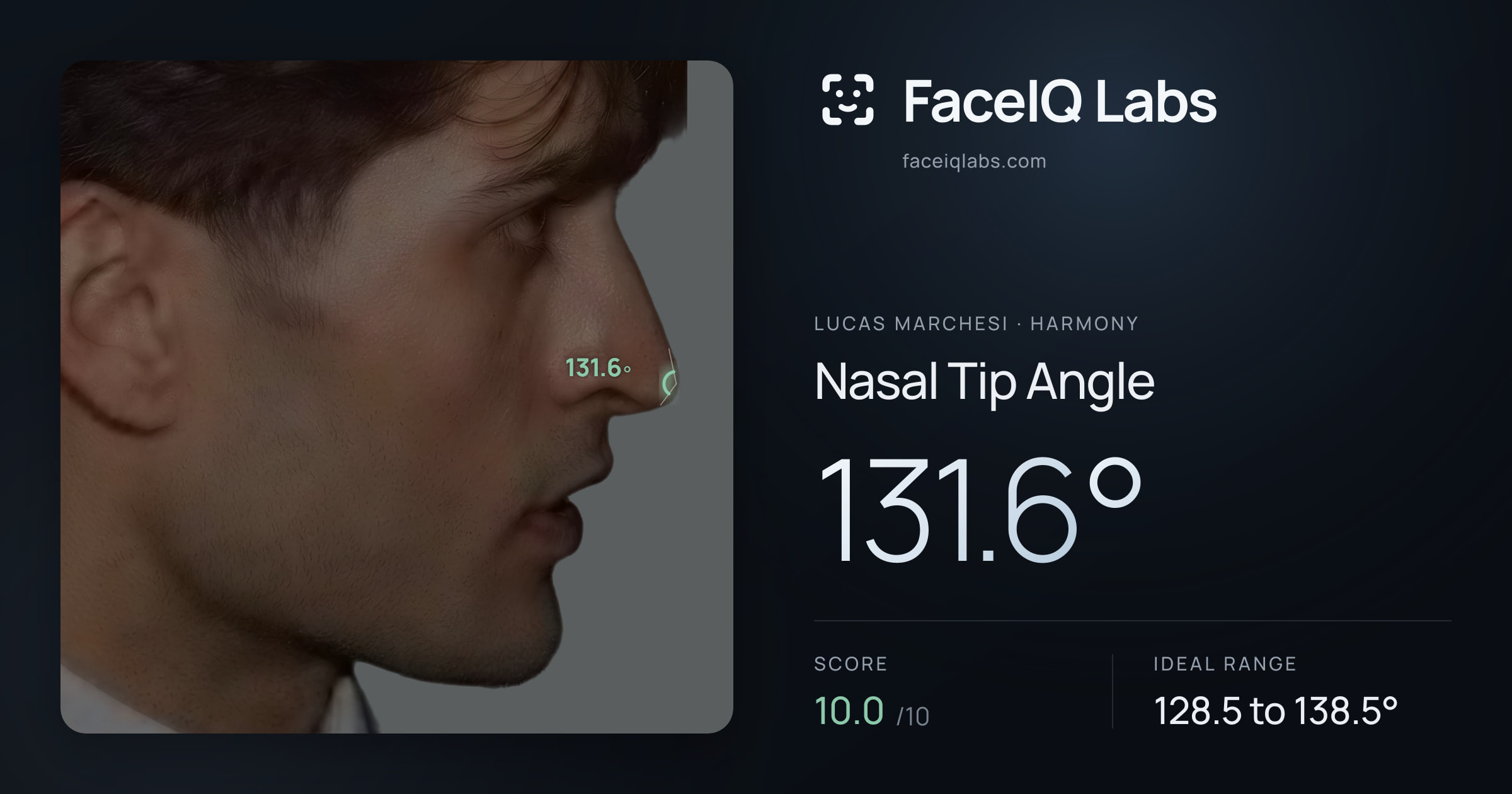 Lucas Marchesi Nasal Tip Angle: 131.6°, drawn on the photo
