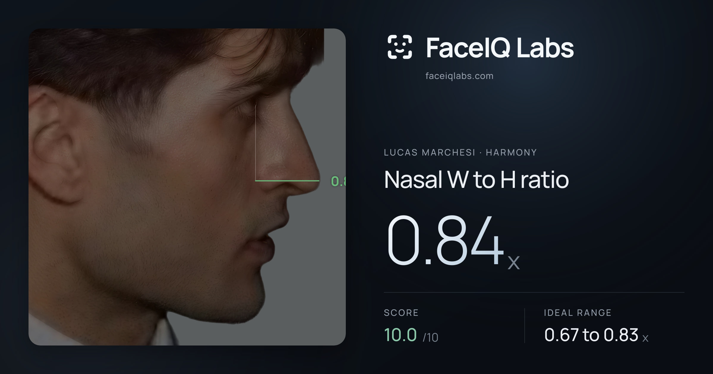 Lucas Marchesi Nasal W to H ratio: 0.84x, drawn on the photo