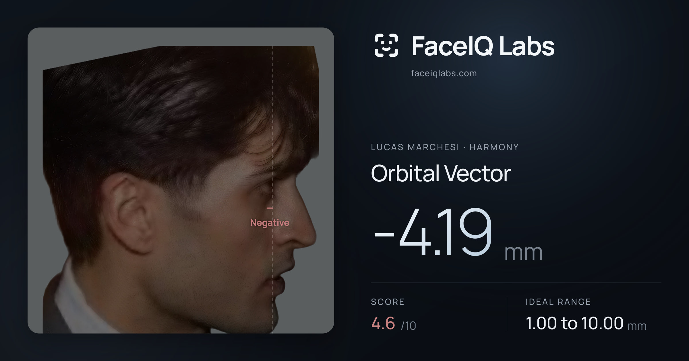 Lucas Marchesi Orbital Vector: -4.19mm, drawn on the photo