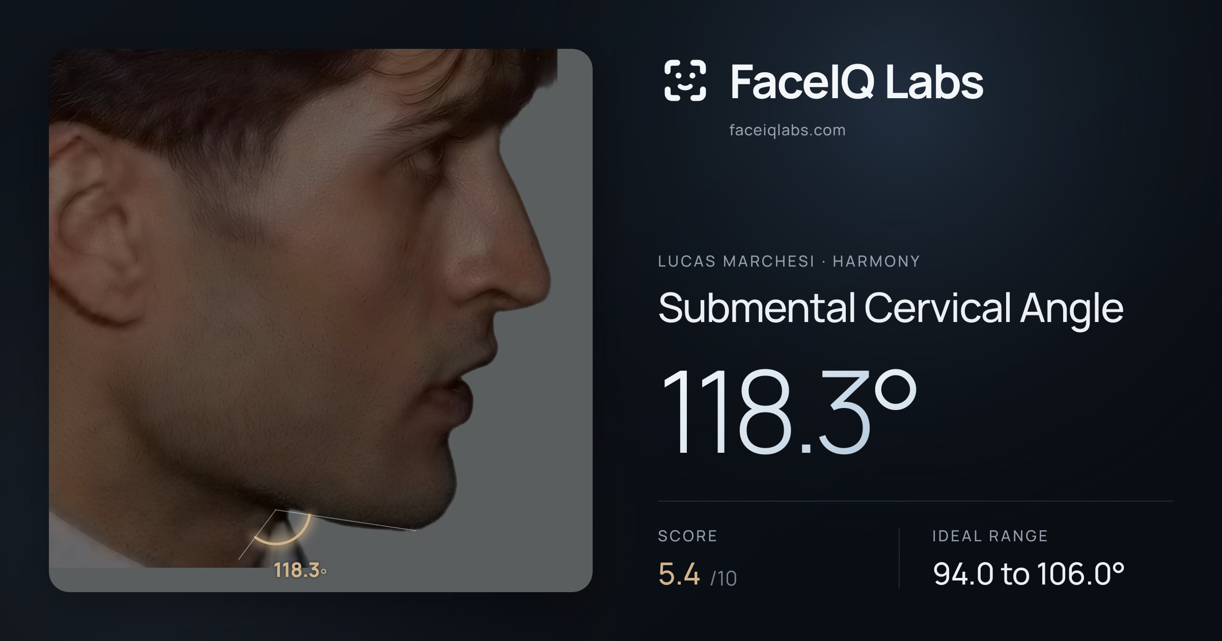 Lucas Marchesi Submental Cervical Angle: 118.3°, drawn on the photo