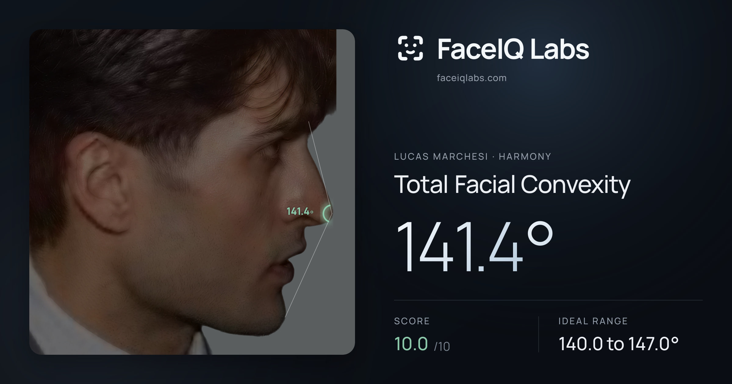 Lucas Marchesi Total Facial Convexity: 141.4°, drawn on the photo