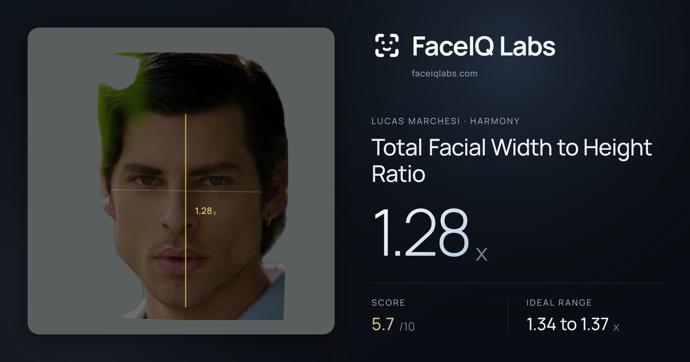 Lucas Marchesi Total Facial Width to Height Ratio: 1.28x, drawn on the photo