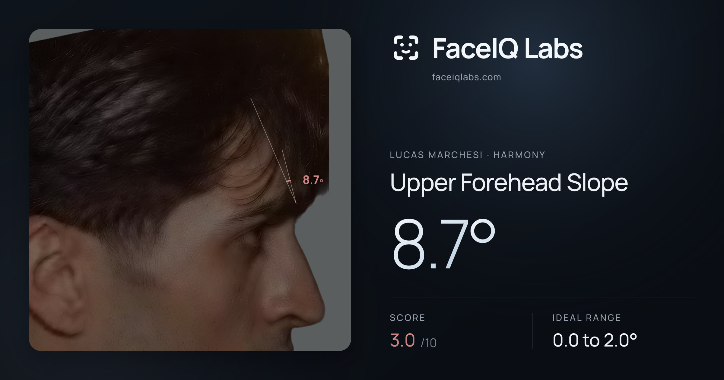 Lucas Marchesi Upper Forehead Slope: 8.7°, drawn on the photo