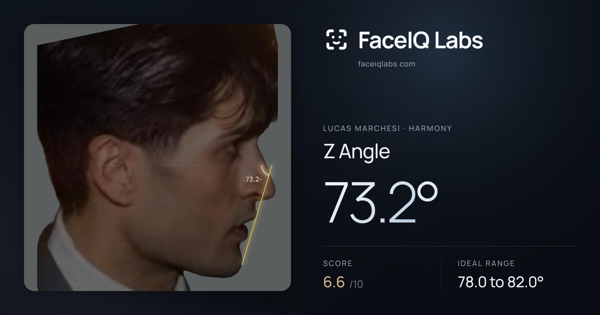 Lucas Marchesi Z Angle: 73.2°, drawn on the photo