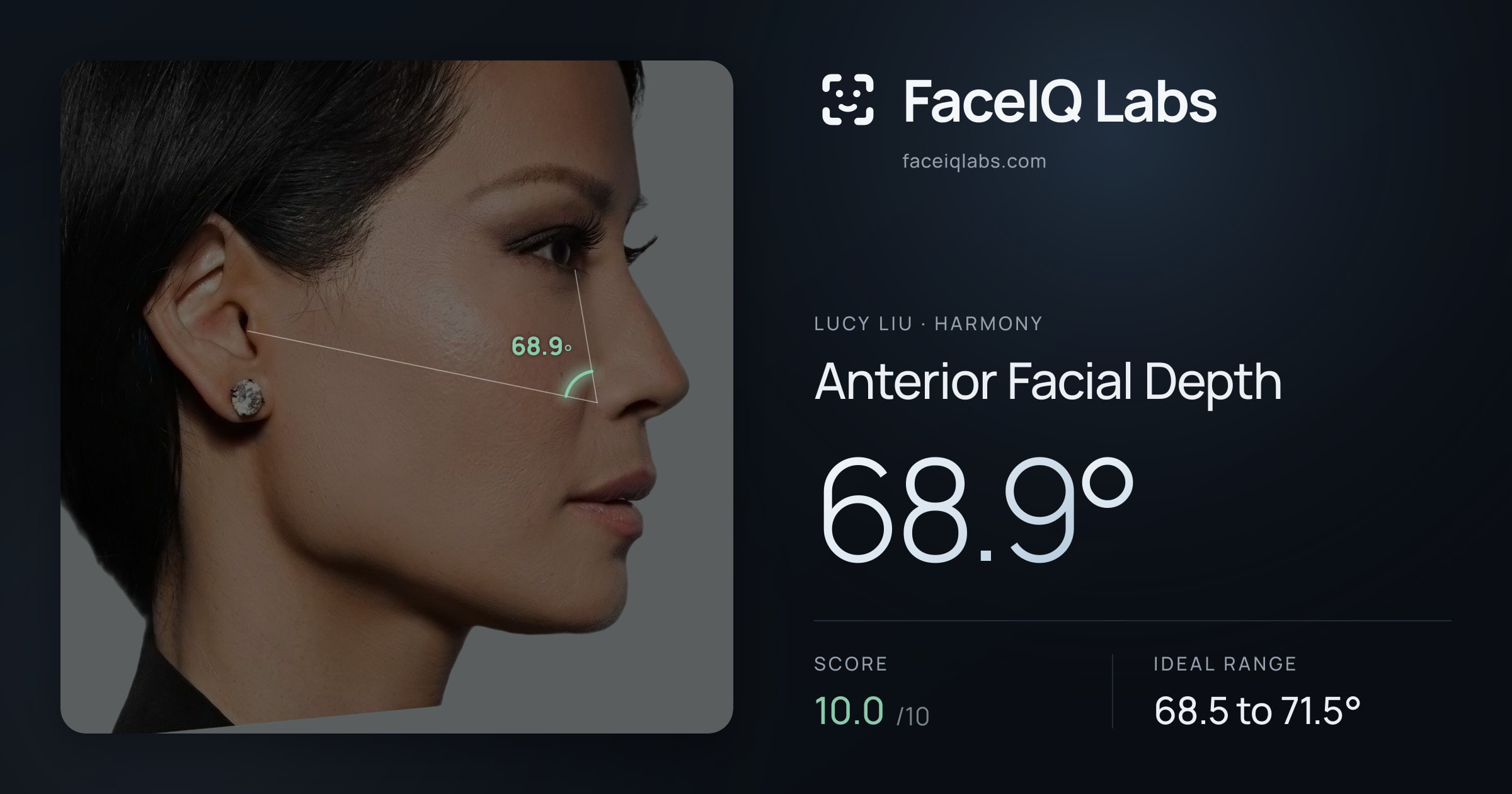 Lucy Liu Anterior Facial Depth: 68.9°, drawn on the photo