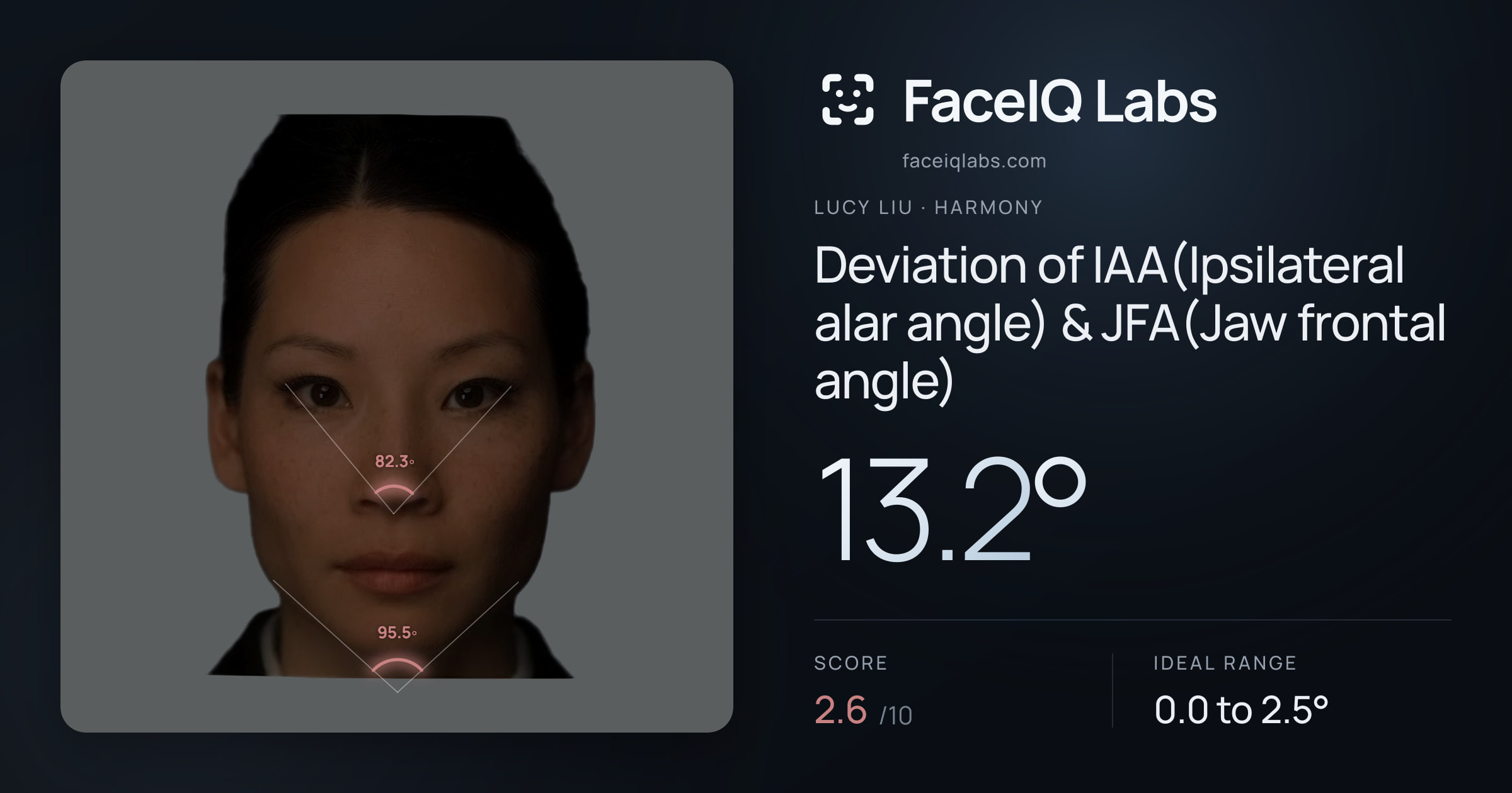 Lucy Liu Deviation of IAA(Ipsilateral alar angle) & JFA(Jaw frontal angle): 13.2°, drawn on the photo