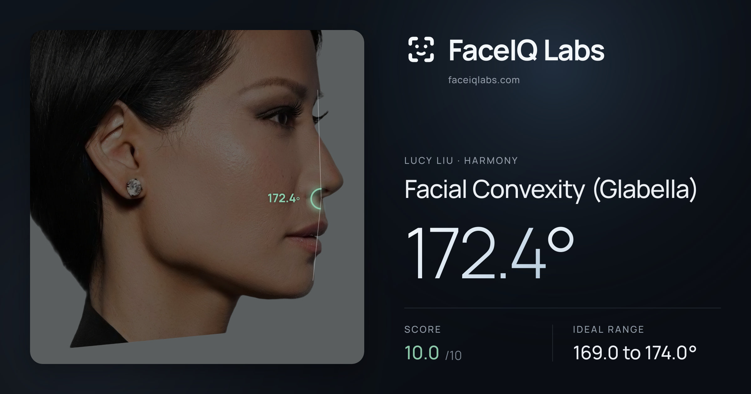 Lucy Liu Facial Convexity (Glabella): 172.4°, drawn on the photo