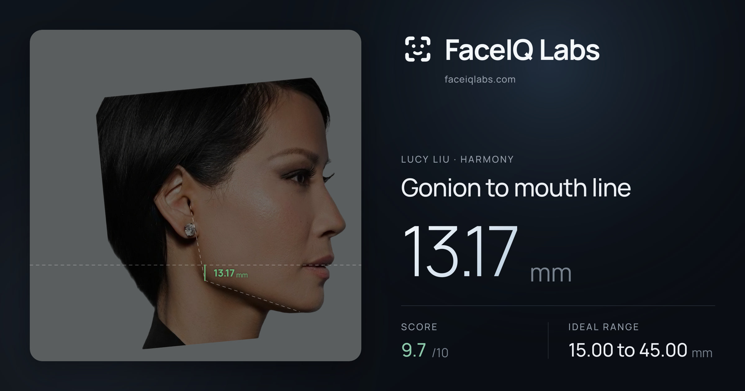 Lucy Liu Gonion to mouth line: 13.17mm, drawn on the photo