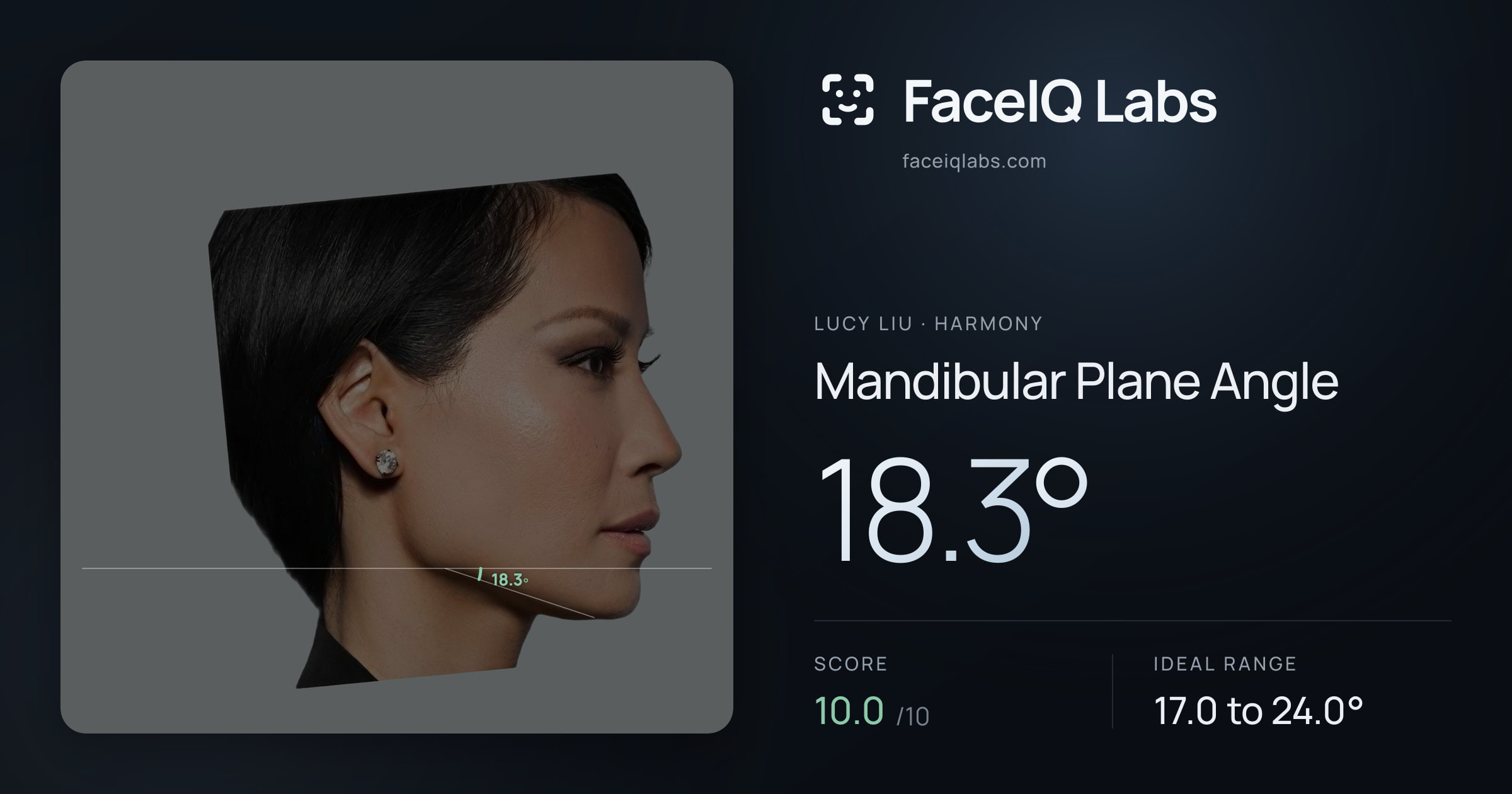 Lucy Liu Mandibular Plane Angle: 18.3°, drawn on the photo
