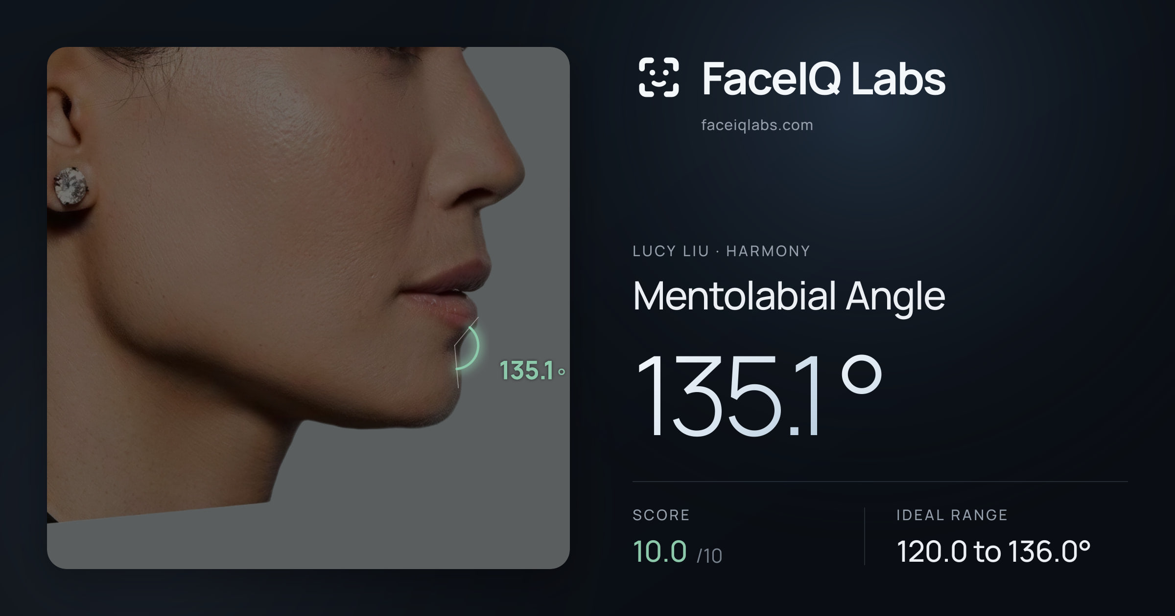 Lucy Liu Mentolabial Angle: 135.1°, drawn on the photo