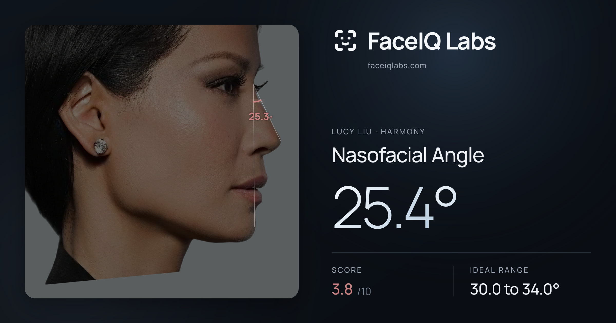 Lucy Liu Nasofacial Angle: 25.4°, drawn on the photo