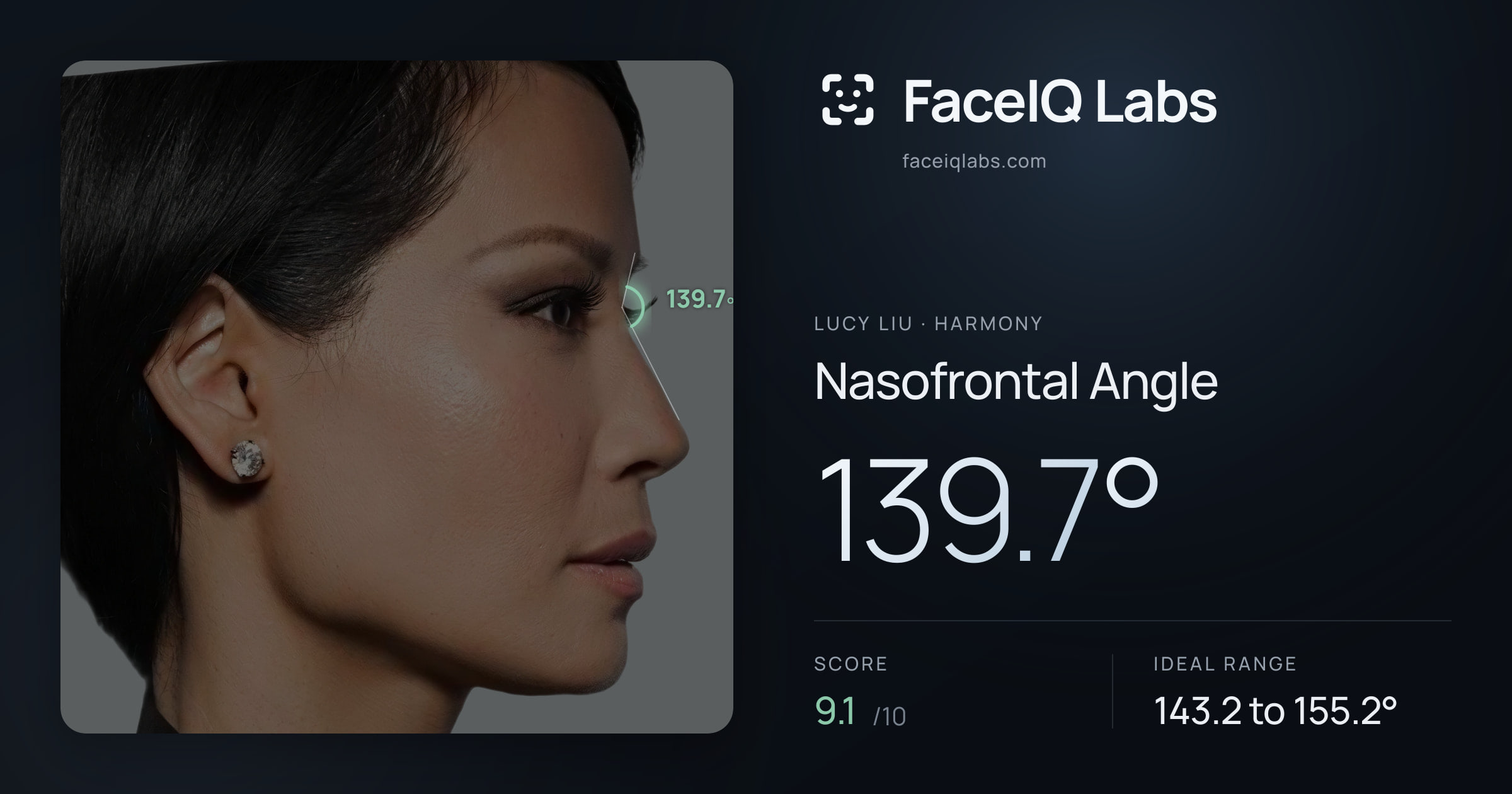 Lucy Liu Nasofrontal Angle: 139.7°, drawn on the photo